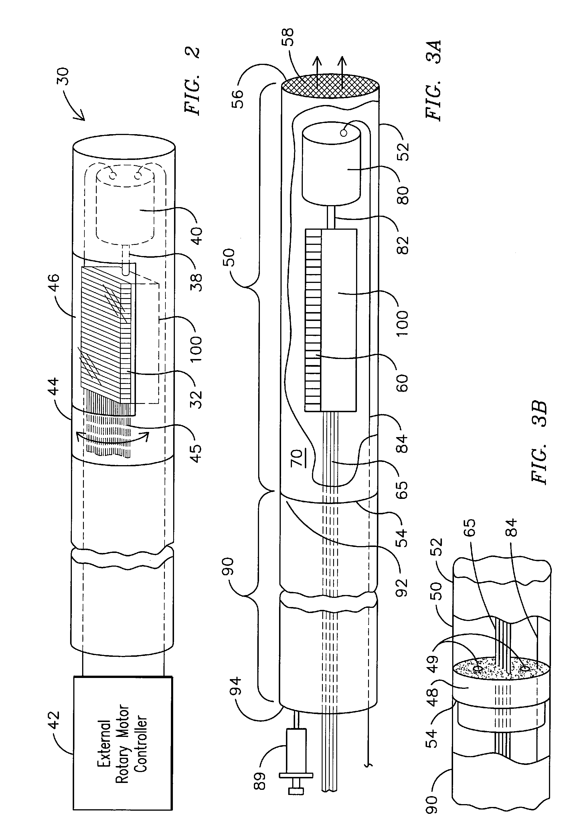 Apparatuses Comprising Catheter Tips, Including Mechanically Scanning Ultrasound Probe Catheter Tip