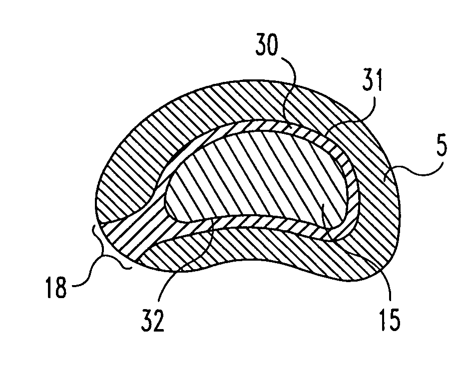 Composite intervertebral disc implants and methods for forming the same