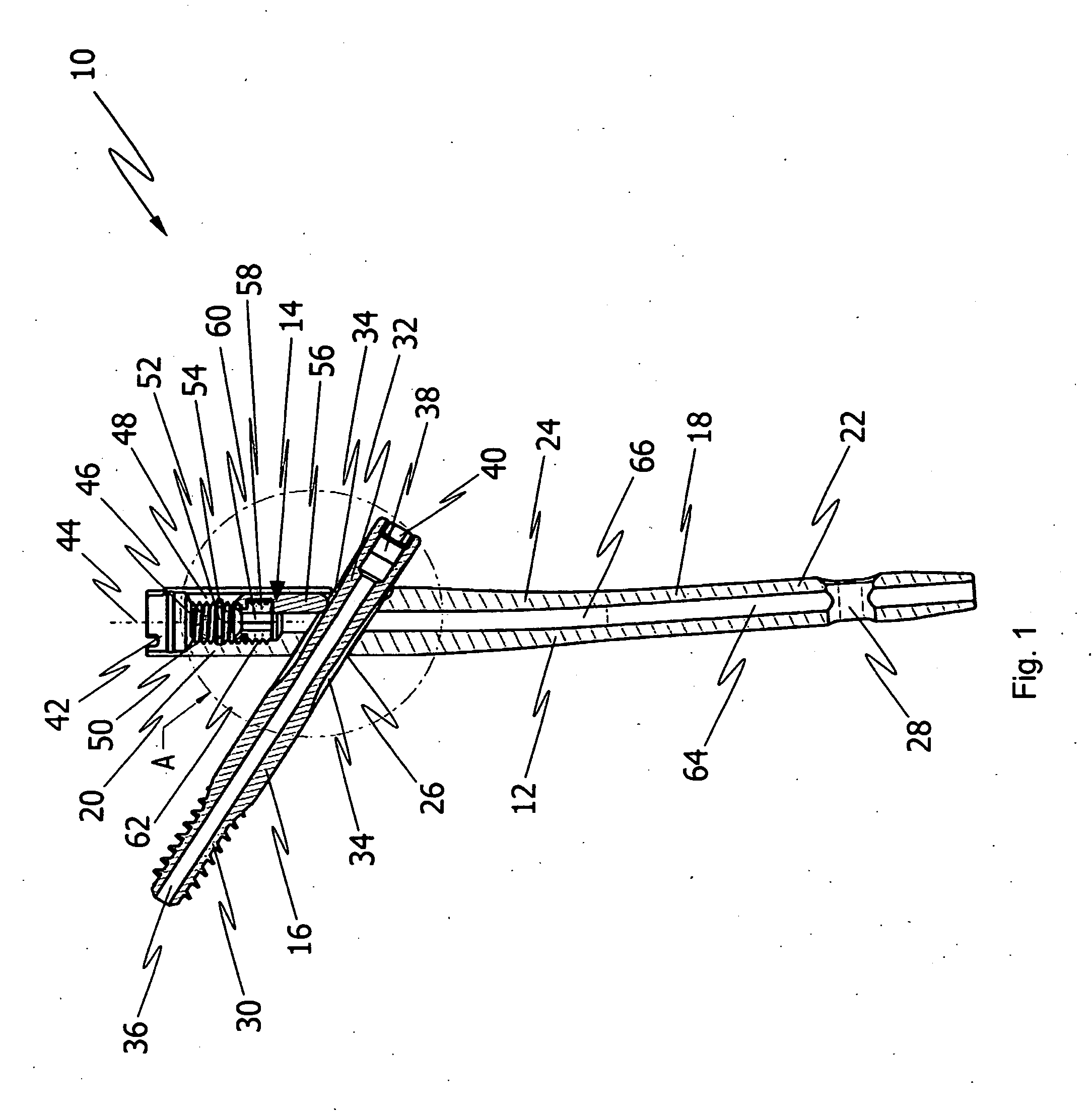 Implant system for bone fixation