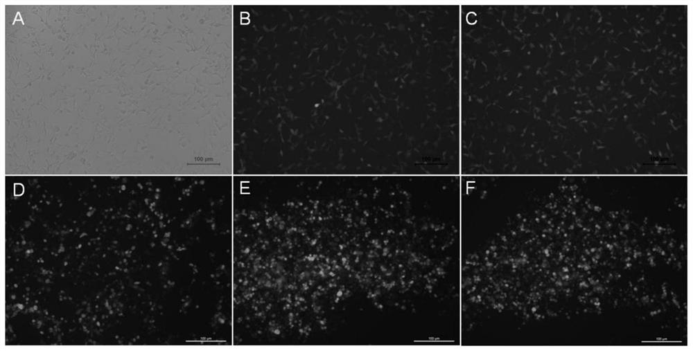 ShRNA for targeted interference of IL-33 expression, recombinant adenovirus vectors as well as construction method thereof, and application
