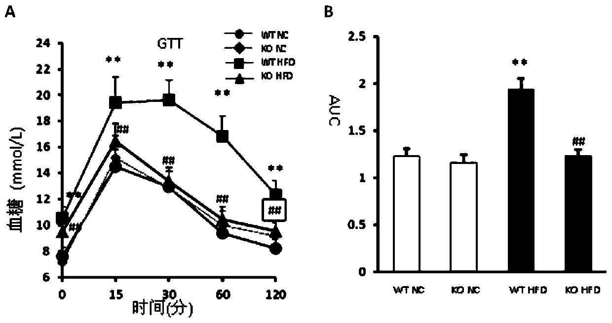 Function and application of G-protein signaling regulator 6 and its inhibitors in the treatment of fatty liver and type Ⅱ diabetes