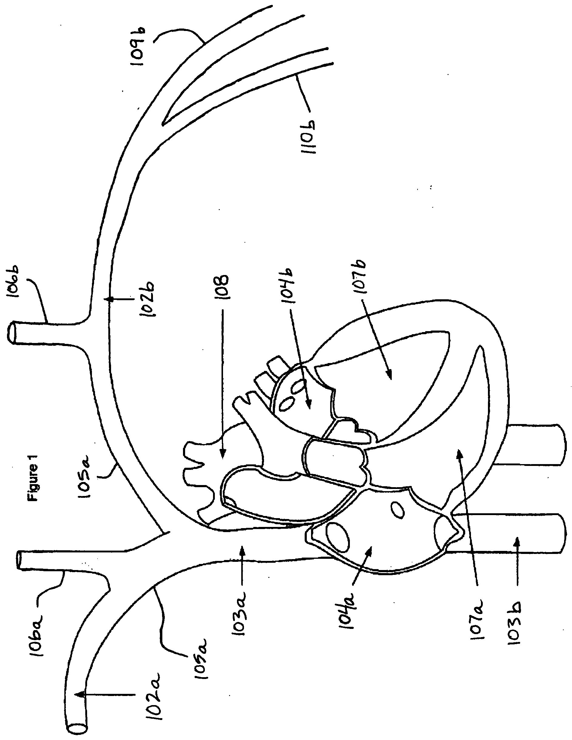 Intravascular implantable device having superior anchoring arrangement