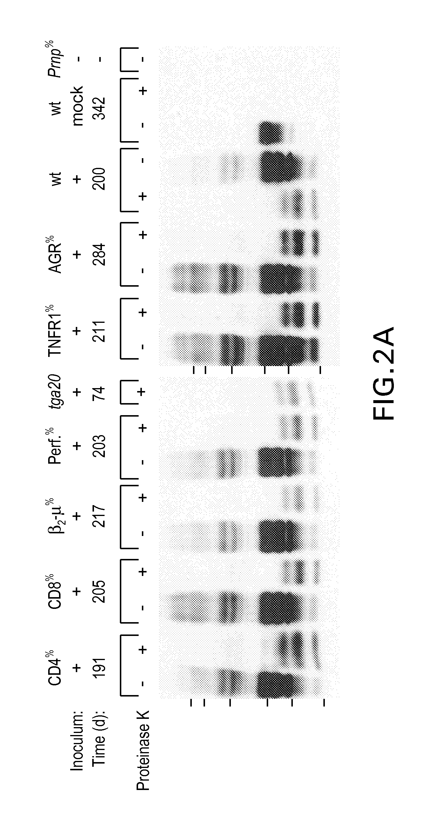 Diagnostics And Therapeutics For Transmissible Spongiform Encephalopathy And Methods For The Manufacture Of Non-Infective Blood Products And Tissued Derived Products
