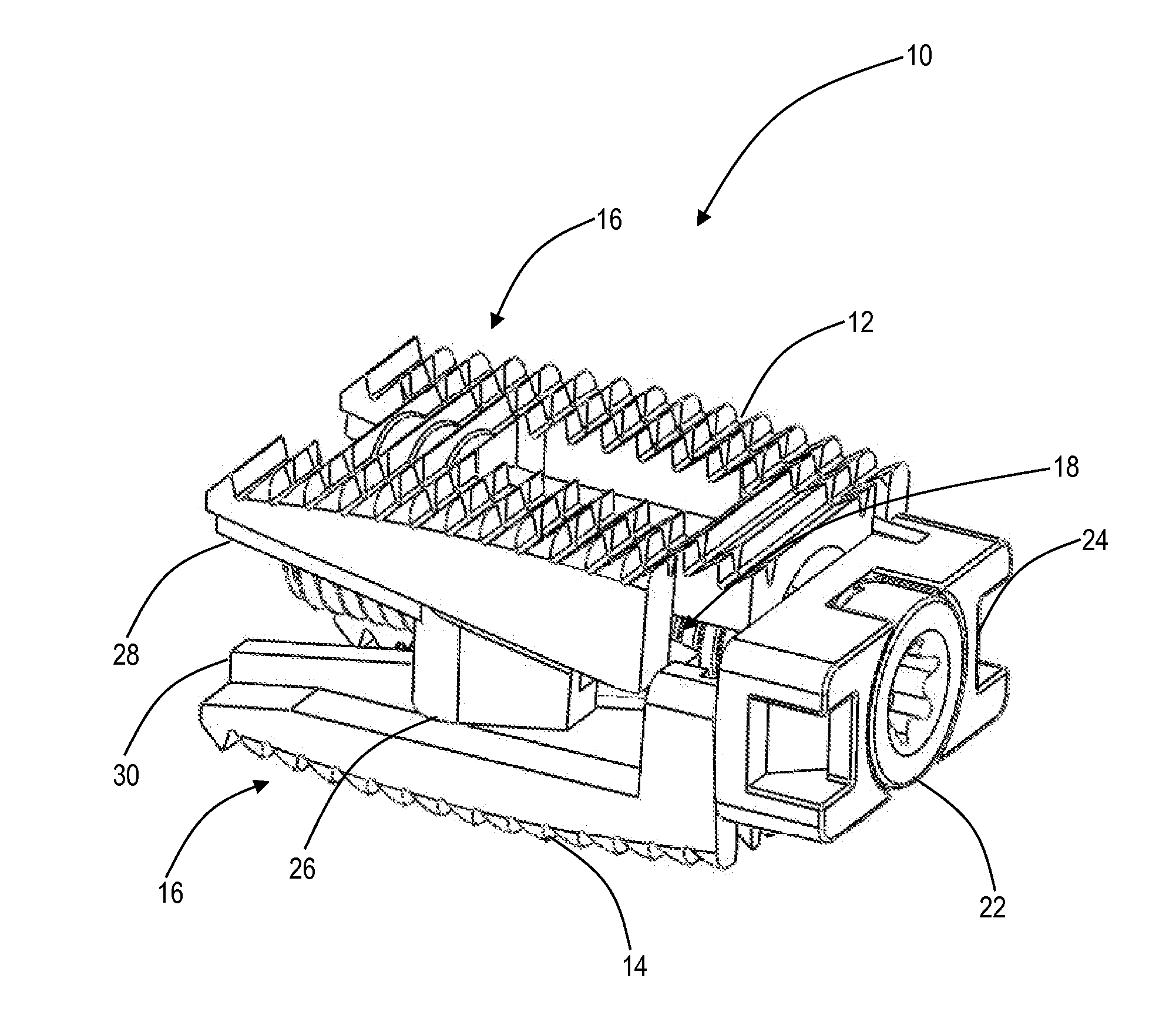 Expandable intervertebral implant and associated surgical method