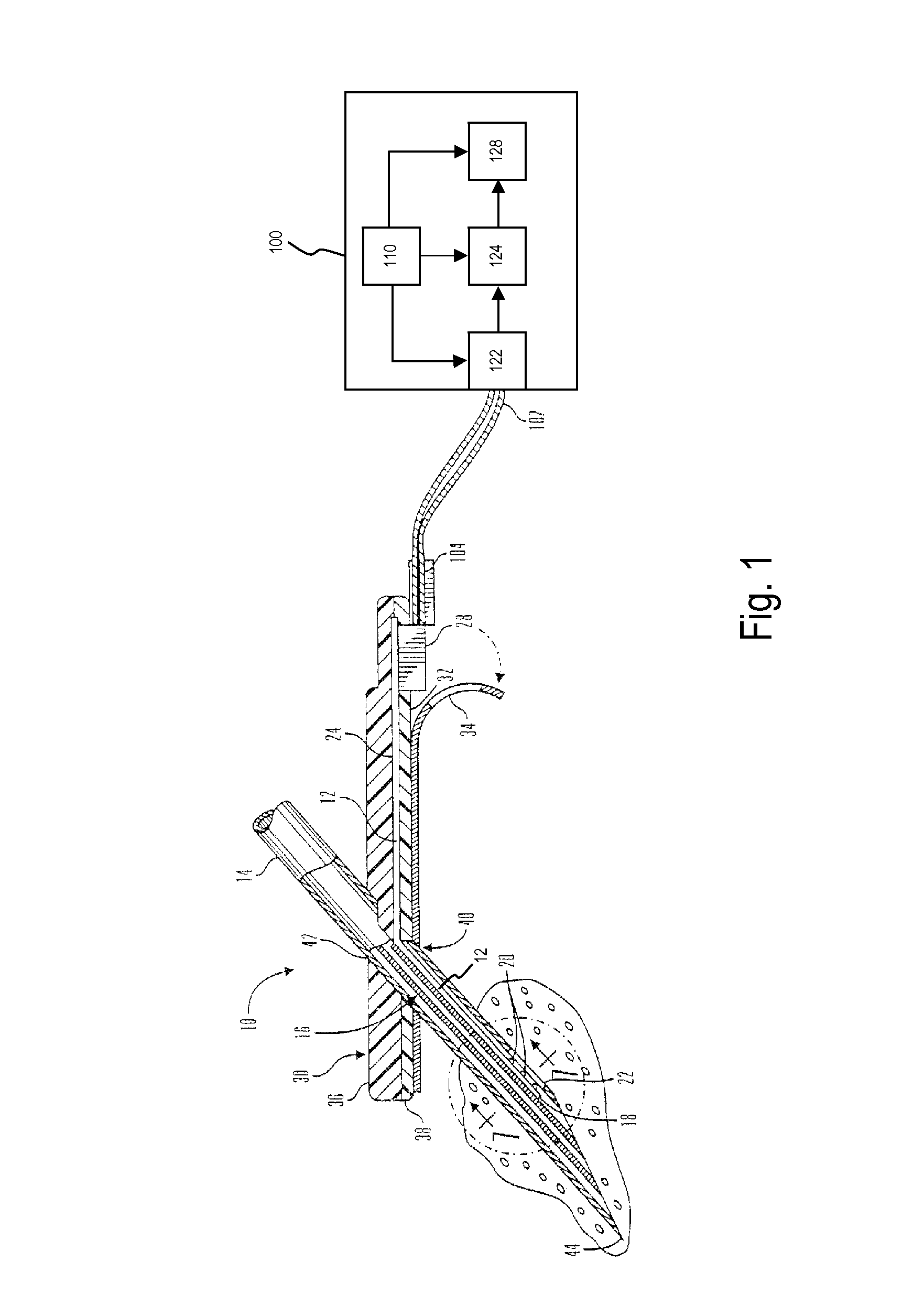 Method and system for remedying sensor malfunctions detected by electrochemical impedance spectroscopy