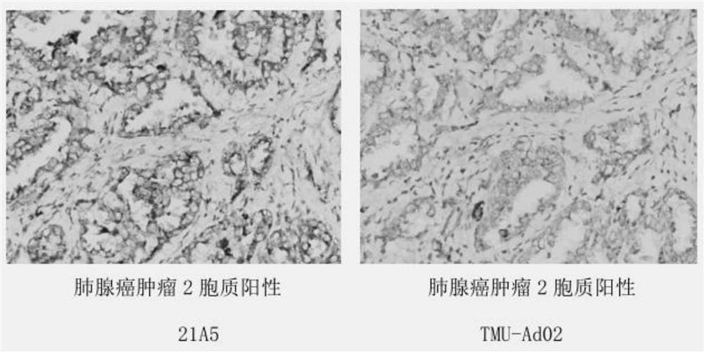 Anti-napsin A protein monoclonal antibody and its cell line, preparation method and application