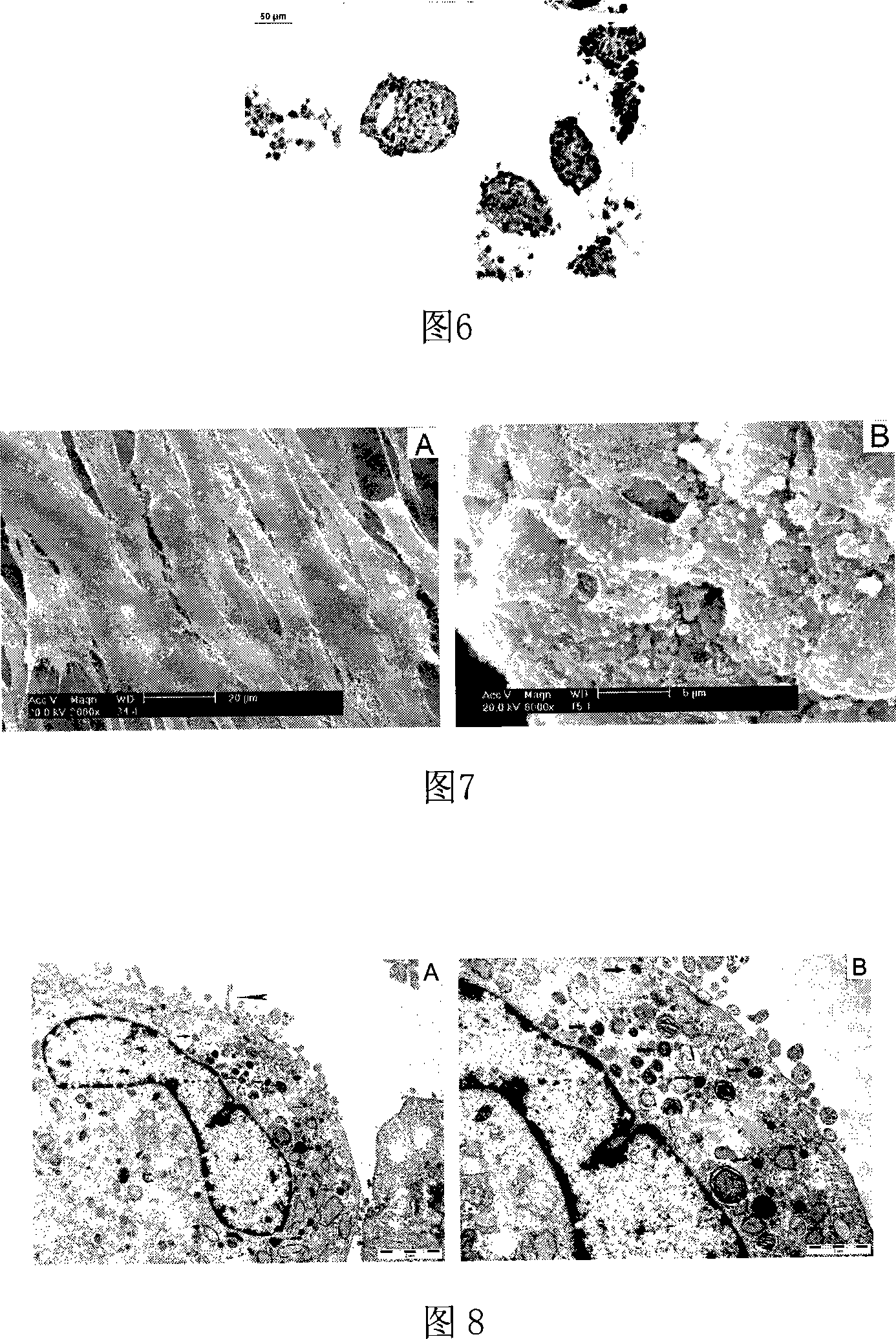 Method for inducing differentiation of human embryo mesenchymal stem cells into pancreatic islet beta-like cell