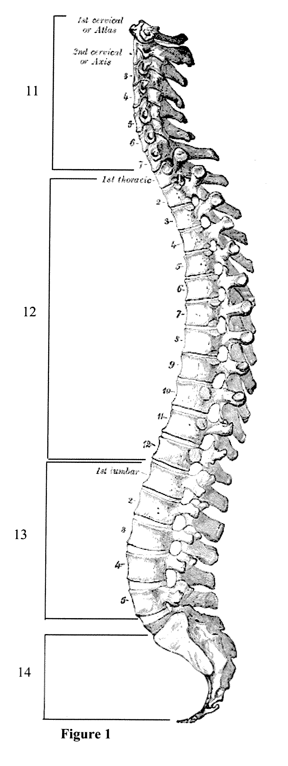 System and Method for Spinal Cord and Vertebrae Segmentation