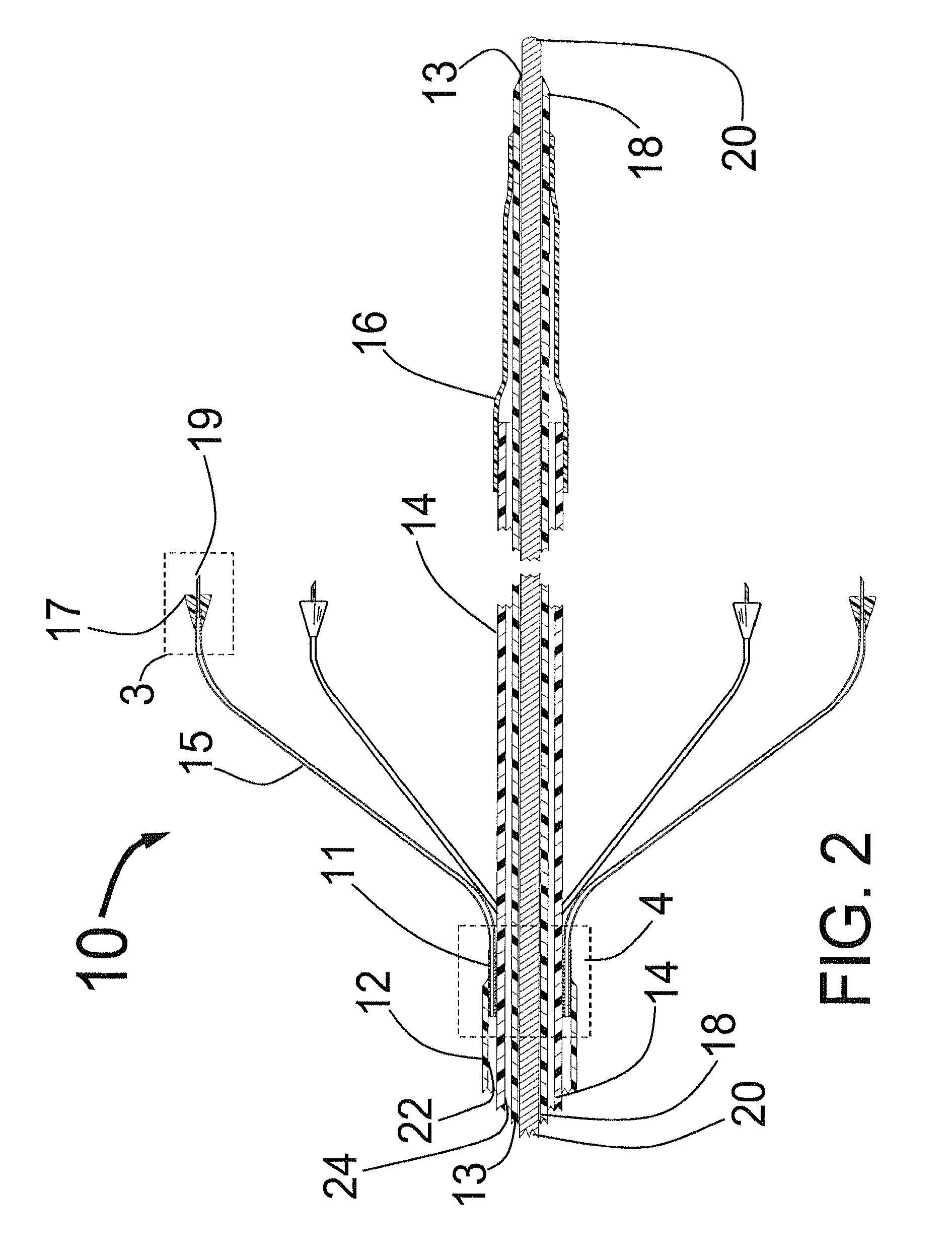 Expandable catheter system for peri-ostial injection and muscle and nerve fiber ablation