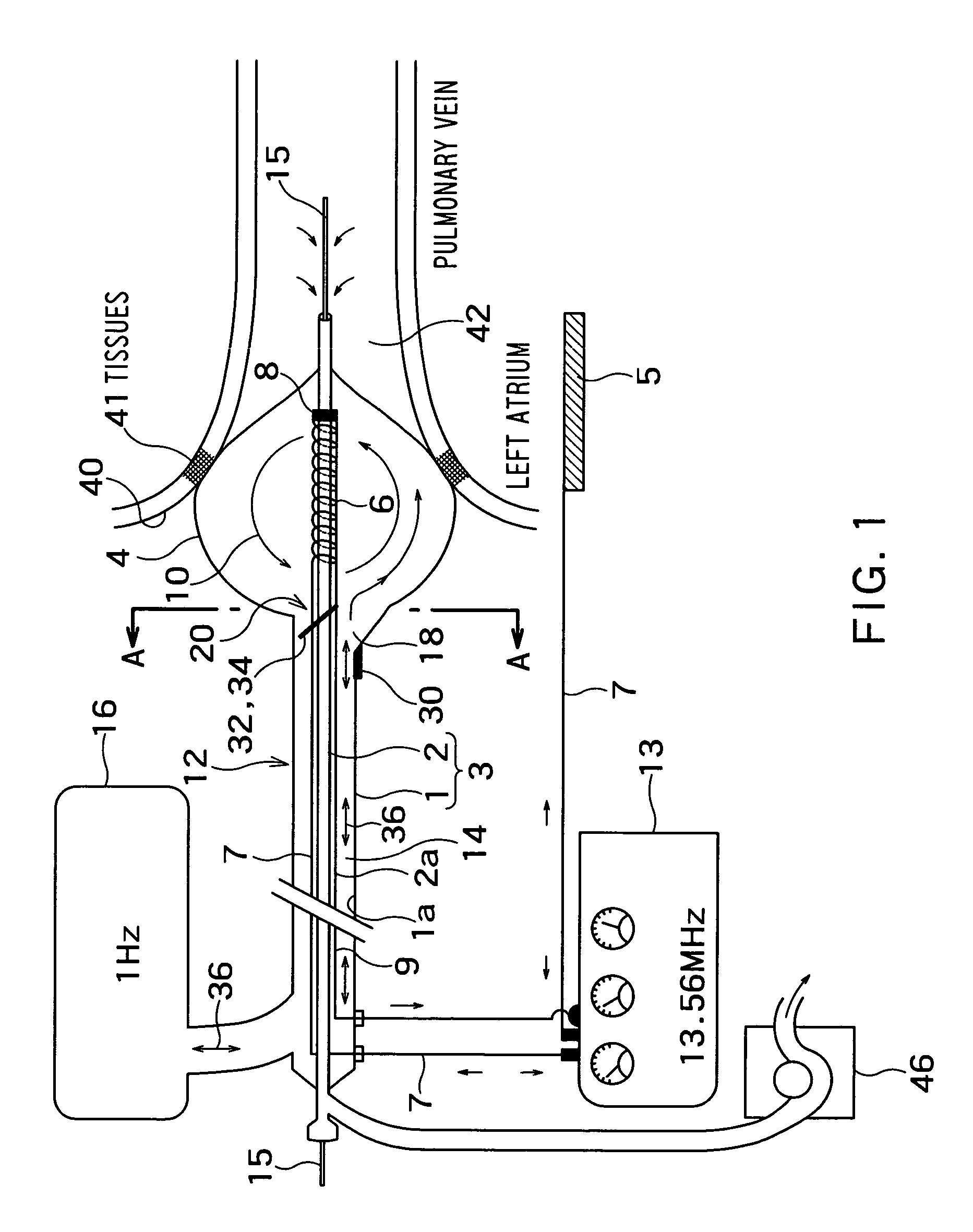 Radio-frequency thermal balloon catheter