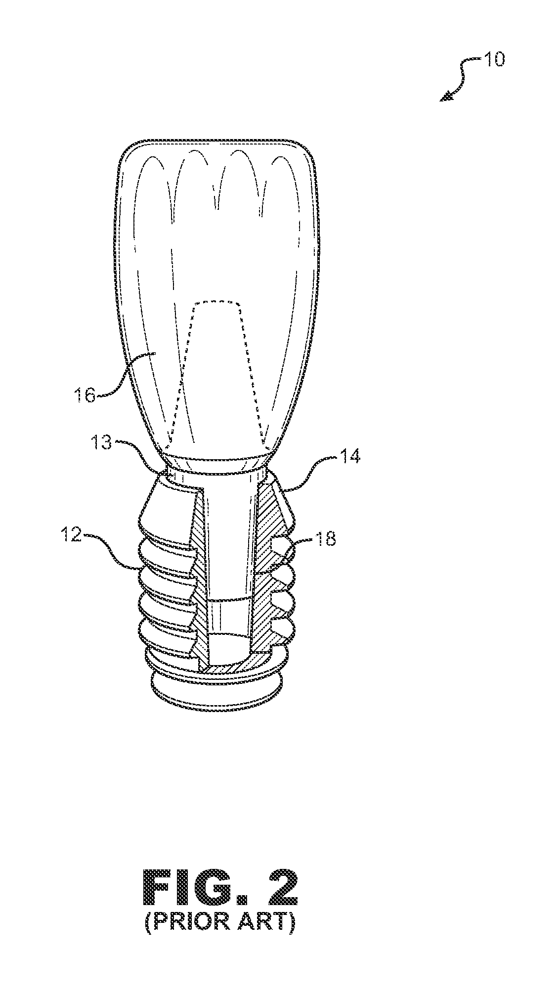 Dental Implant System and Method of Use