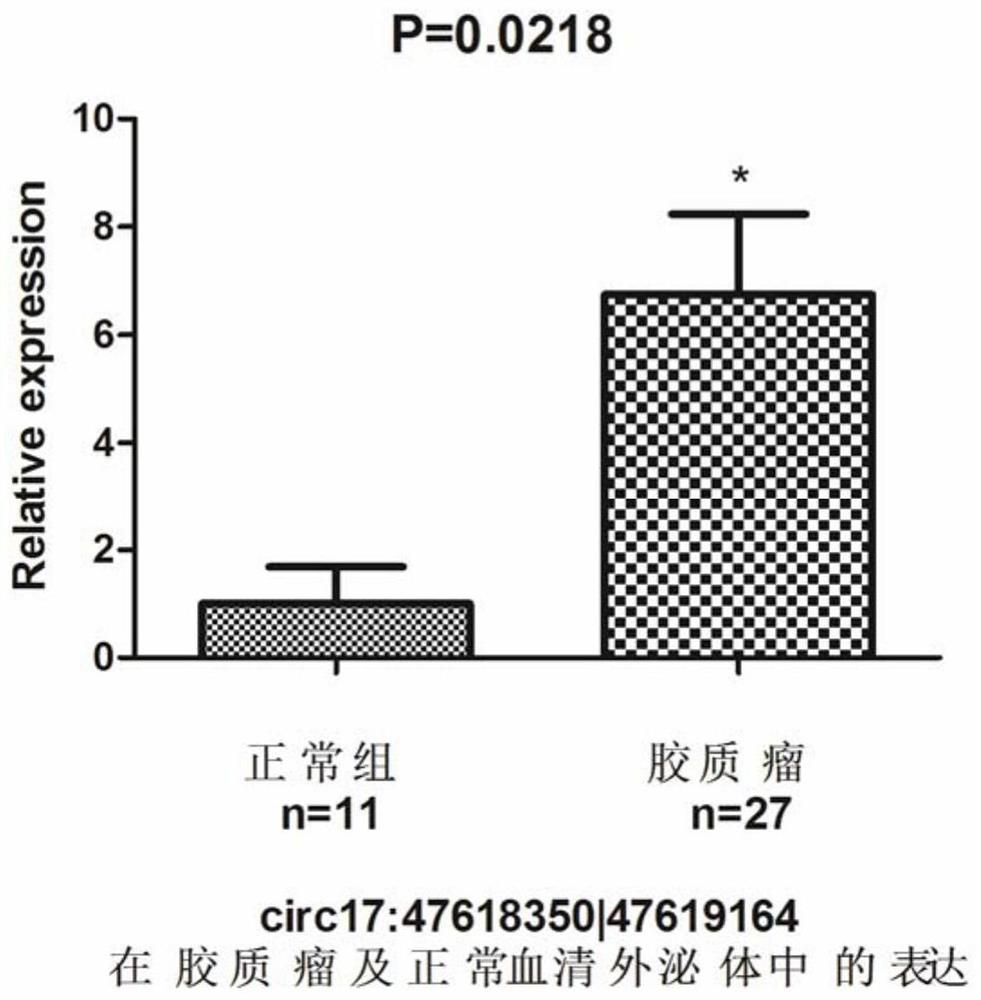 Glioma diagnostic marker circ17:47618350|47619164 and its application