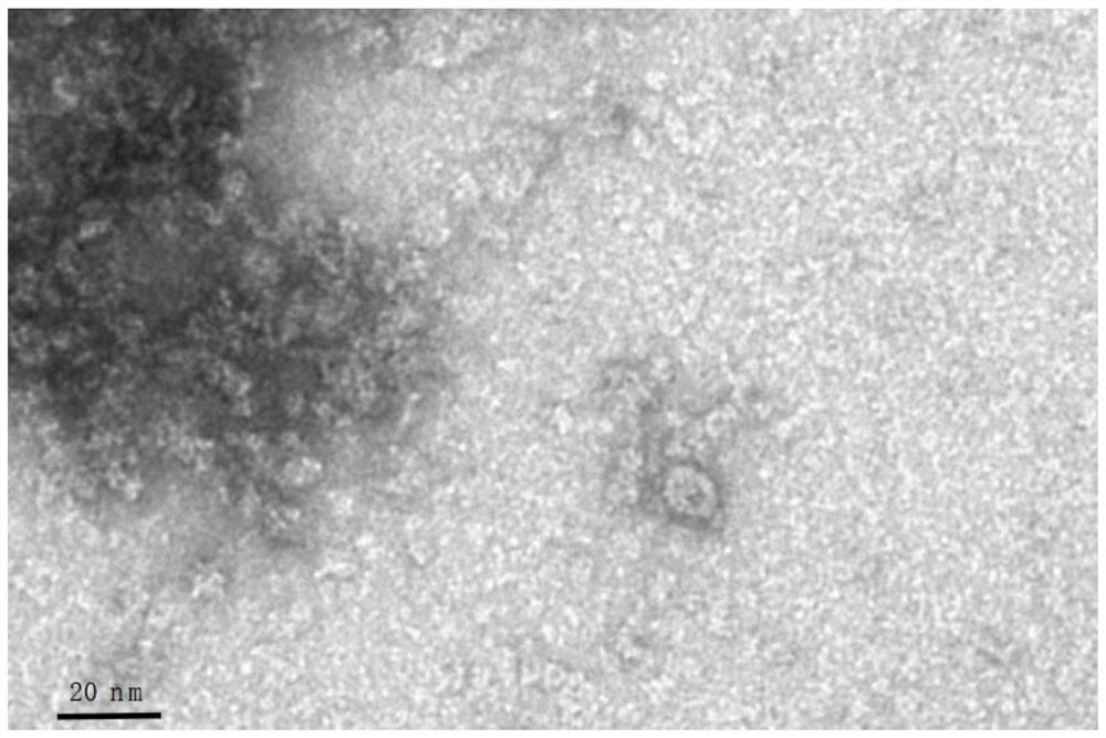 Nanometer antigen particle based on self-assembled ferritin, infectious bursal disease vaccine prepared from nanometer antigen particle, and application