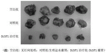 Antitumor traditional Chinese medicine composition as well as preparation and application thereof