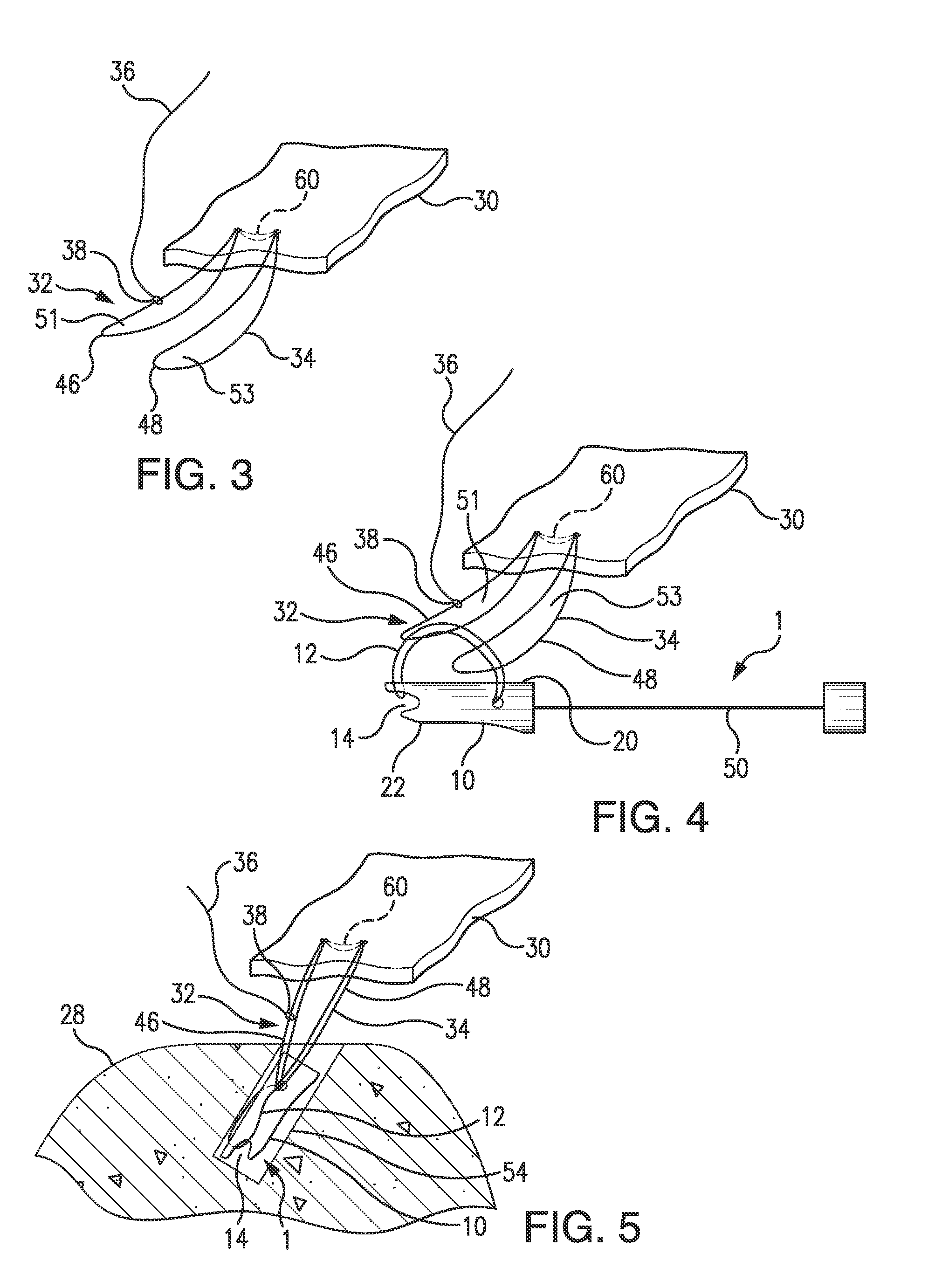 Multi-loop adjustable knotless anchor assembly, adjustable capture mechanism, and method for repair