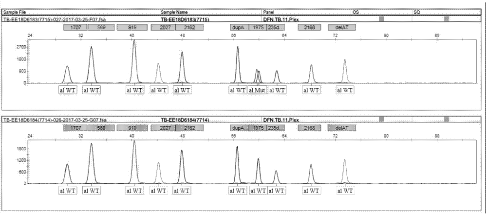 SNaPshot kit for detecting deafness gene polymorphisms on 10 loci