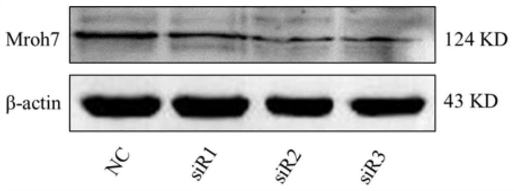 siRNA interfering with mroh7 gene expression and its application, interfering method and drug