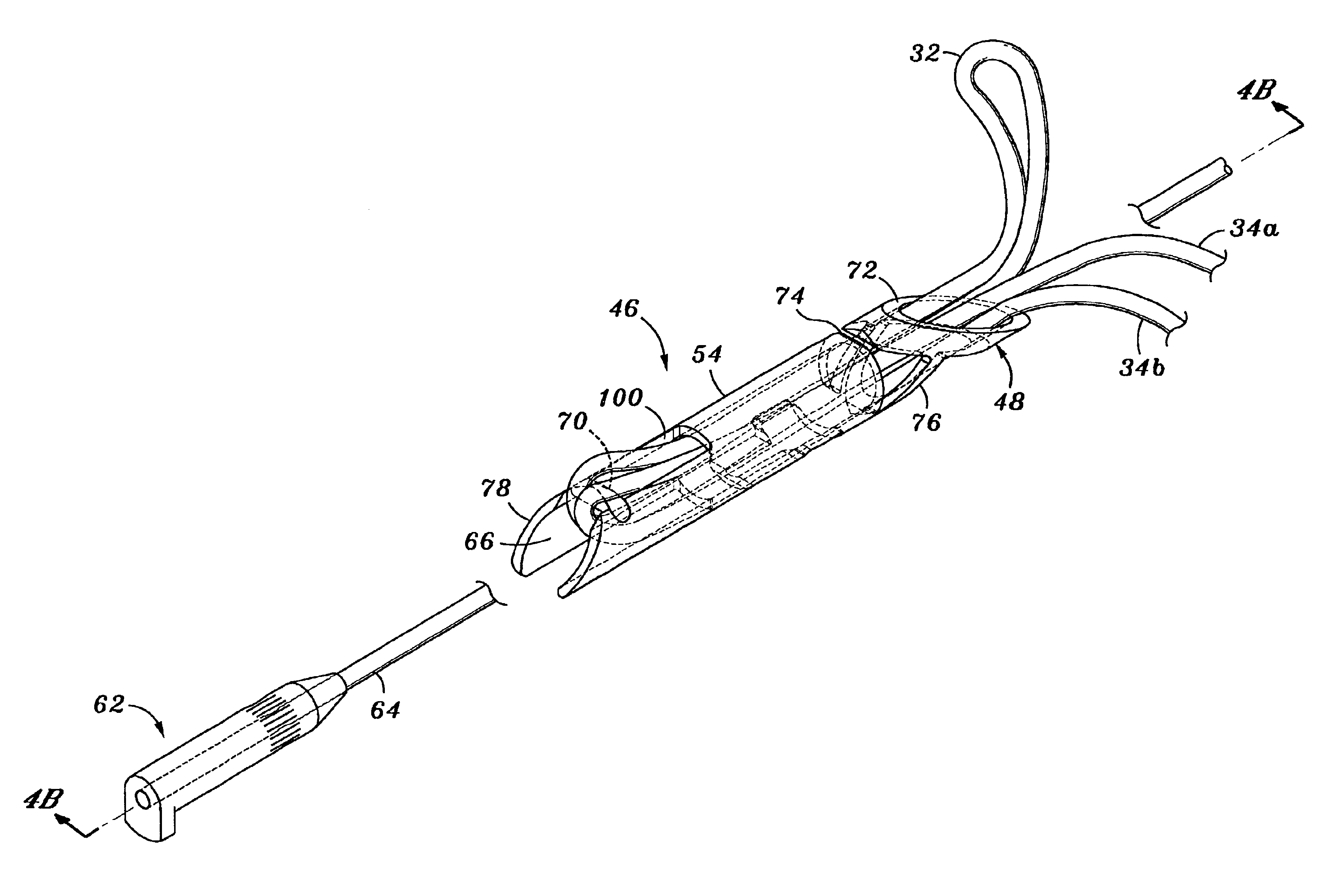 Method and apparatus for attaching connective tissues to bone using a knotless suture anchoring device
