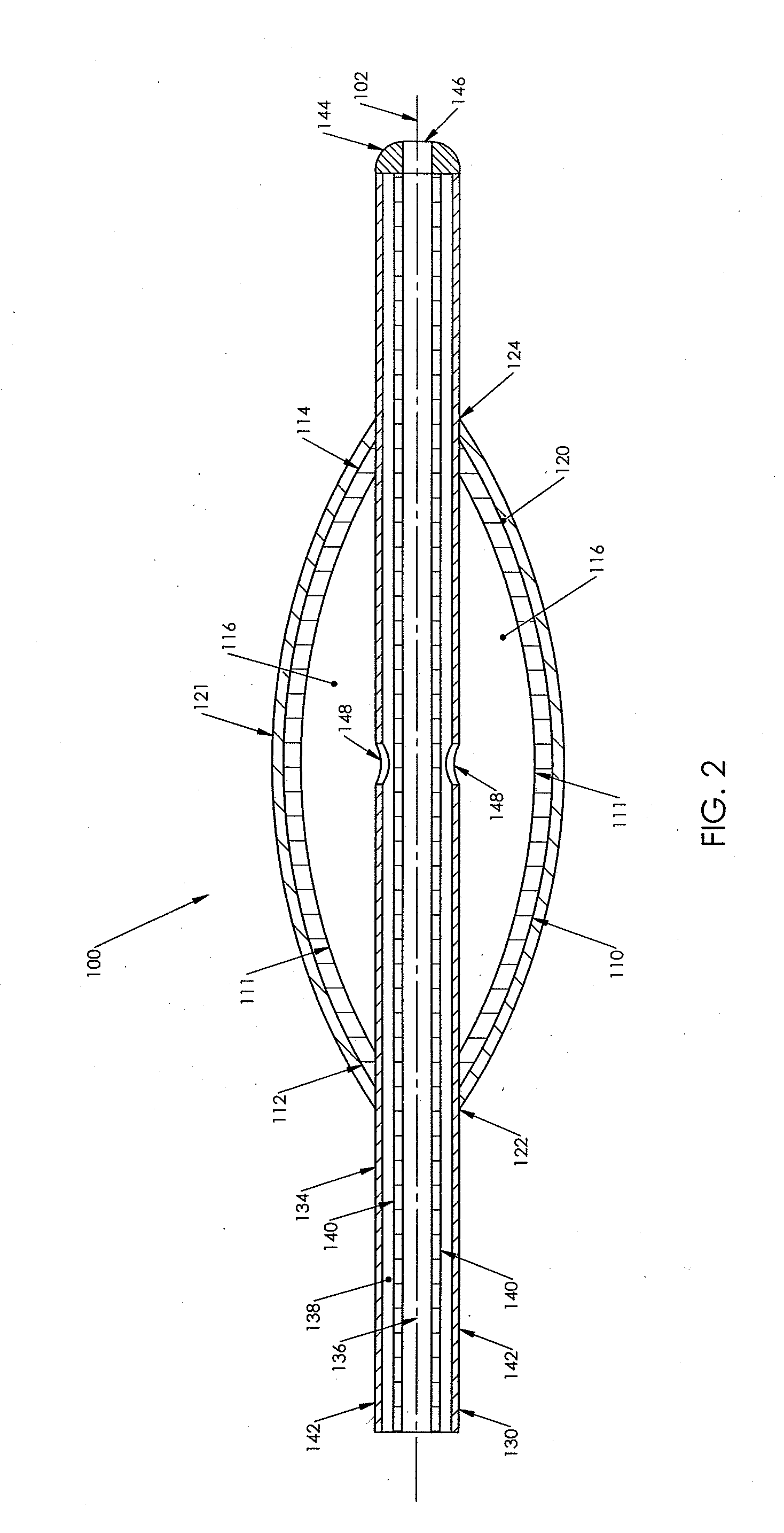 Method for Expanding a Vessel