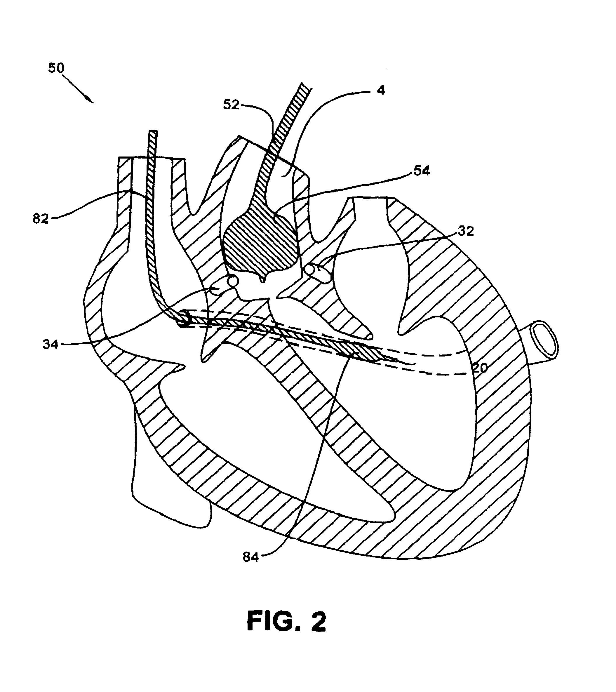 Conduit system for isolation of fluids in biological tissues