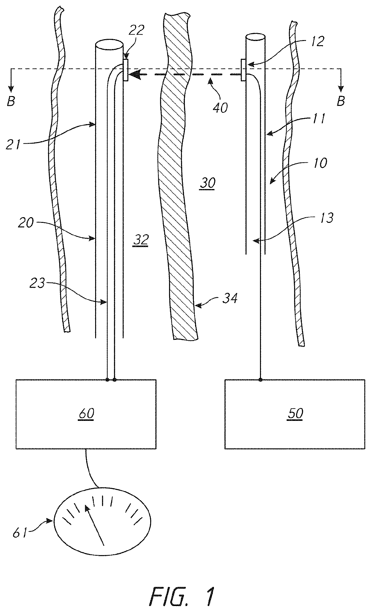 Devices and methods for diverting blood flow from a first vessel