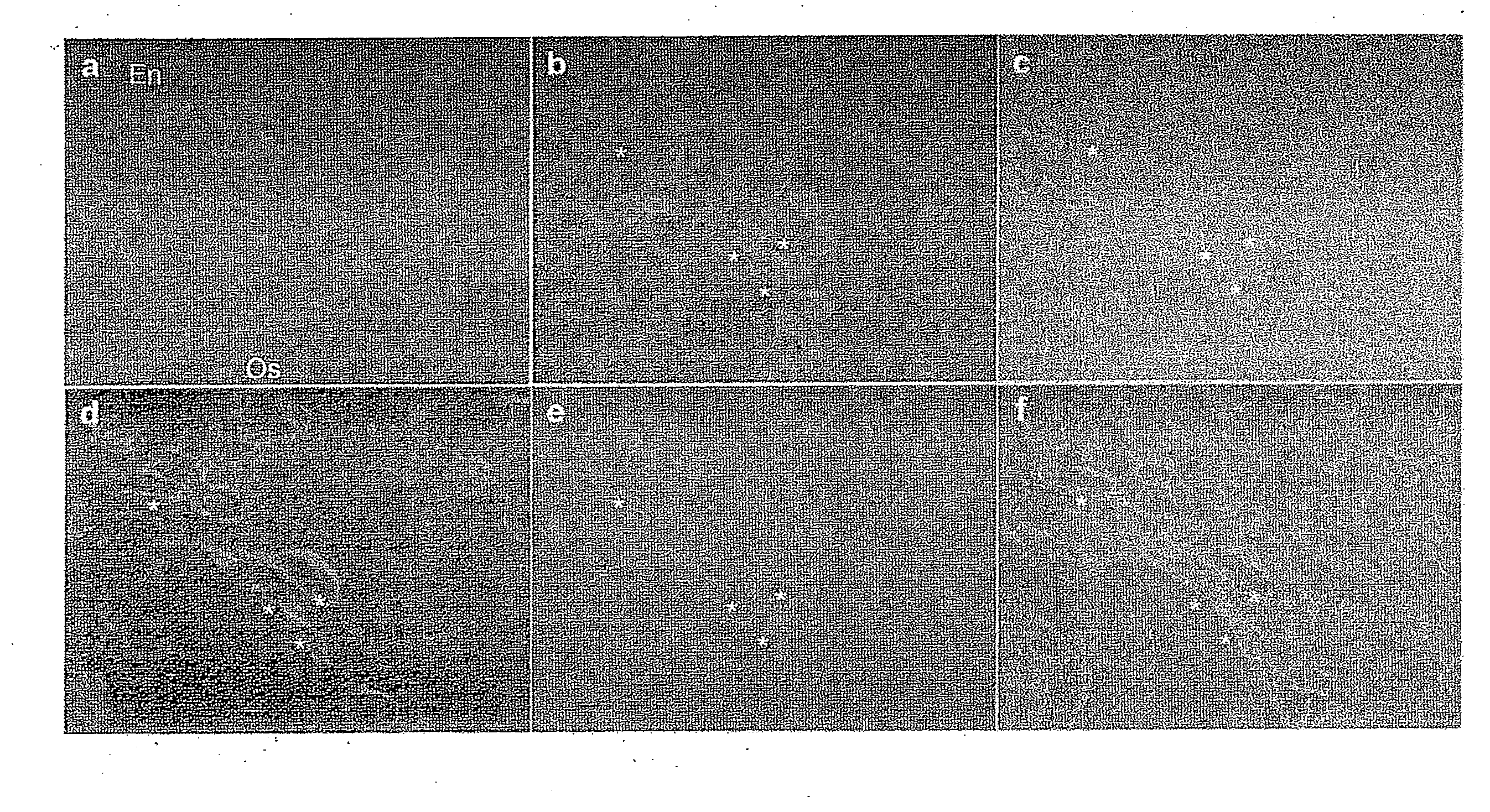 Mouse having human leukemic stem cell and leukemic non-stem cell amplified therein, and method for production thereof