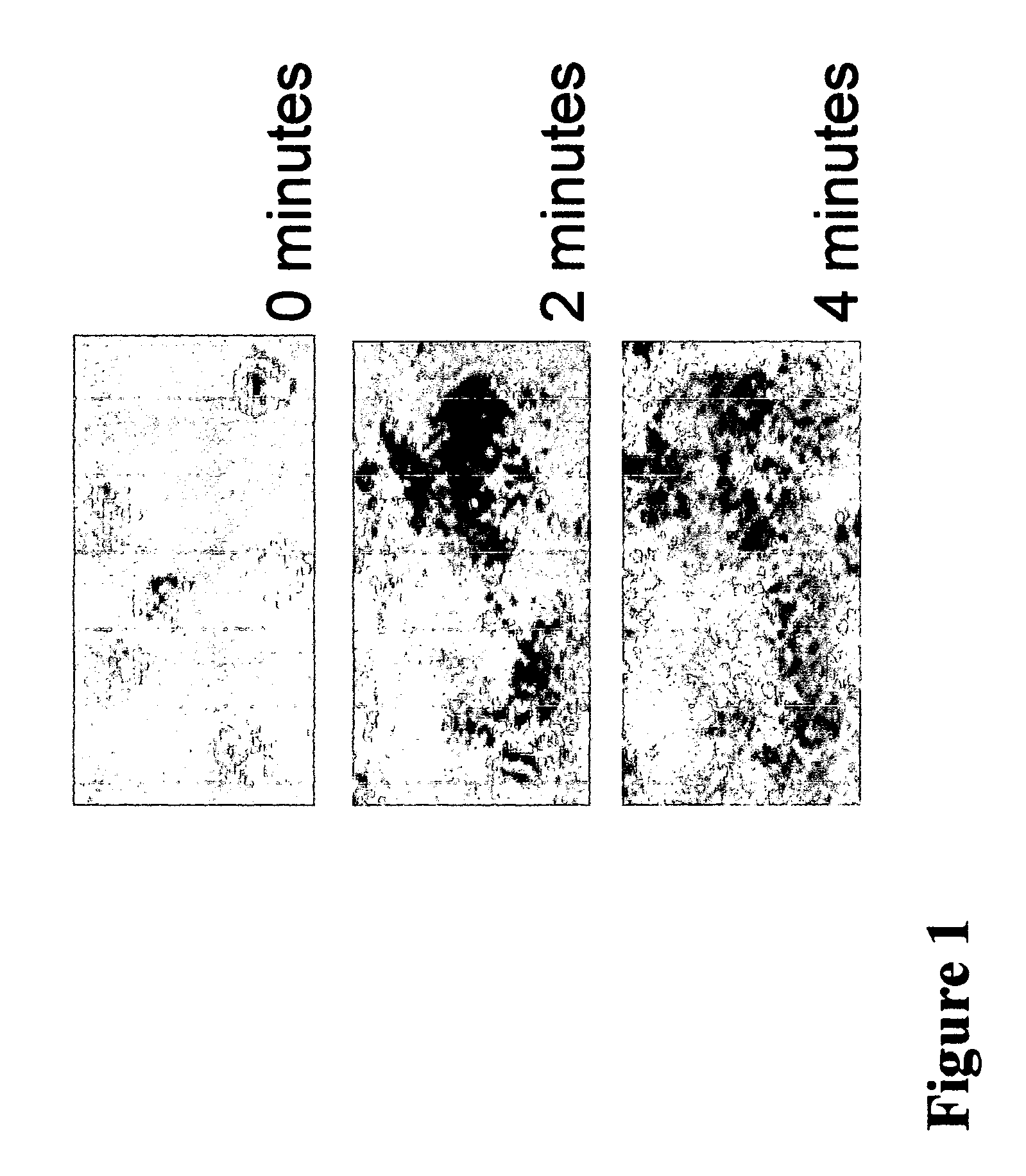 Apparatus and method to measure platelet contractility