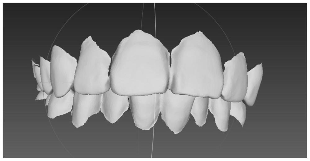 A Restoration Algorithm for Single Teeth Mesh Model
