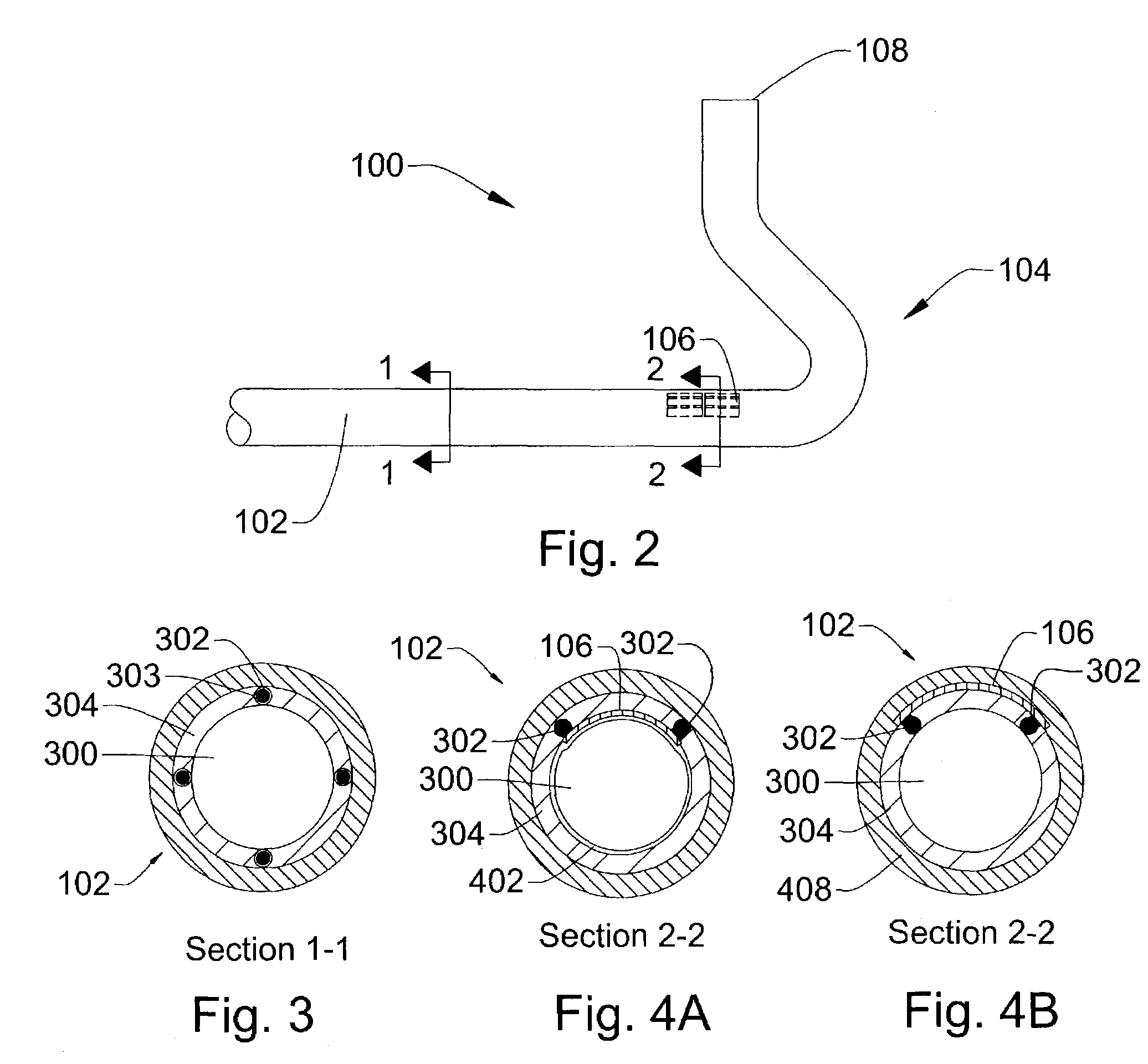 Ultrasound directed guiding catheter system and method