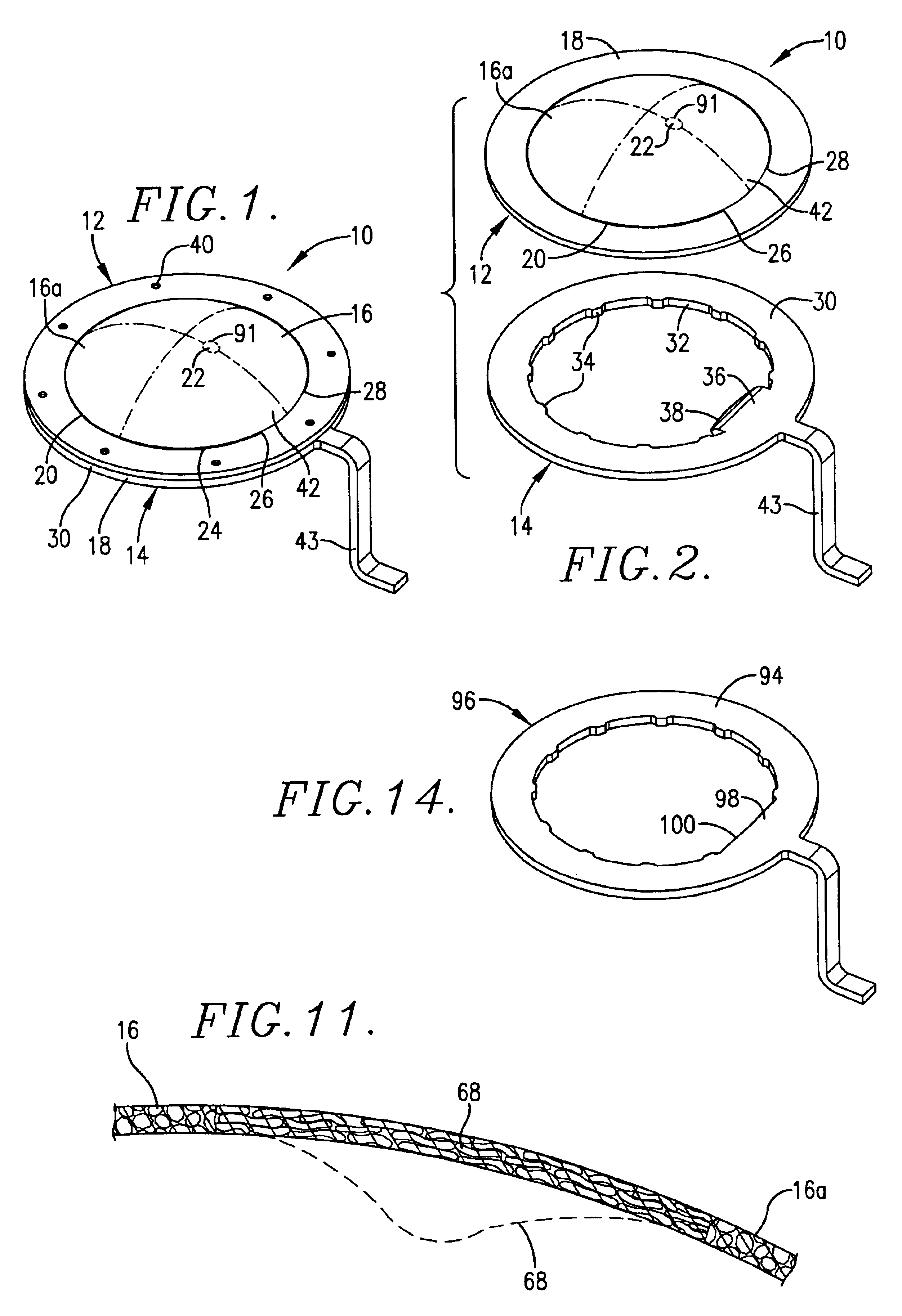 Reverse buckling sanitary rupture disc assembly