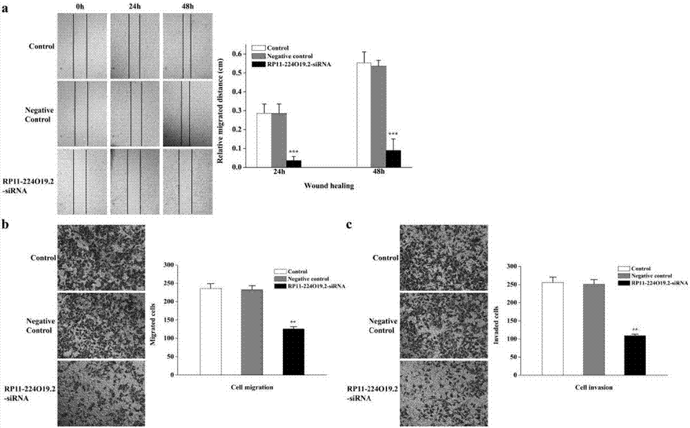 Application of long-chain non-coding RNA RP11-224O19.2 inhibitor