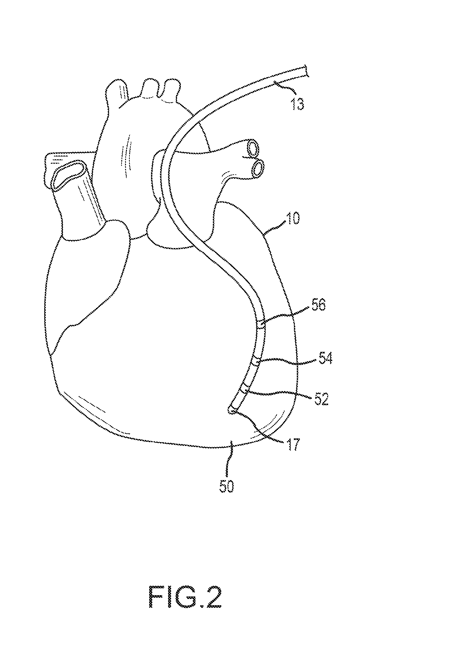 Non-contact mapping system and method