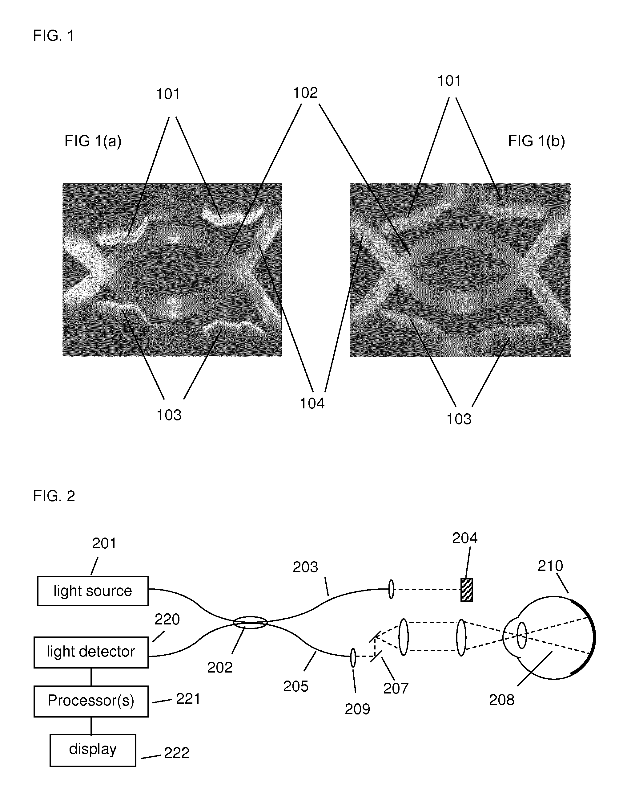 Systems & methods for ocular anterior segment tracking, alignment, and dewarping using optical coherence tomography
