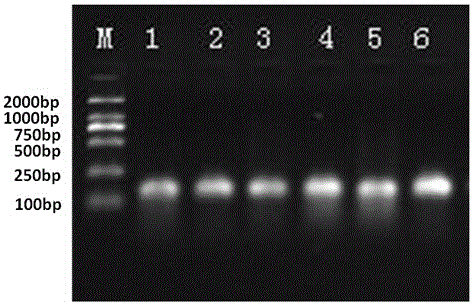 lncRNA ENST00000581794.1 and preparation, diagnostic agent, medicine or kit and application