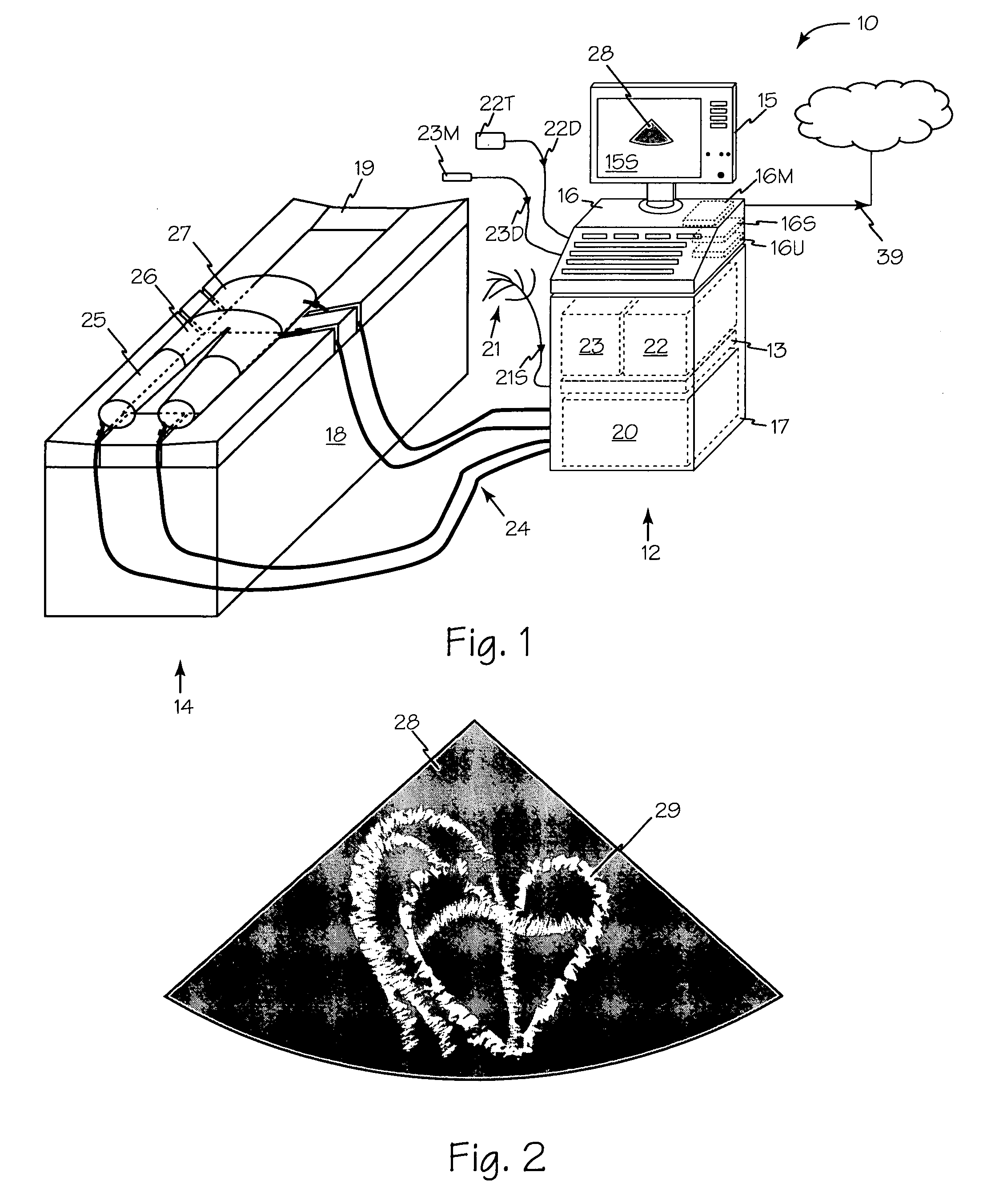 Method and apparatus for image enhanced external counterpulsation