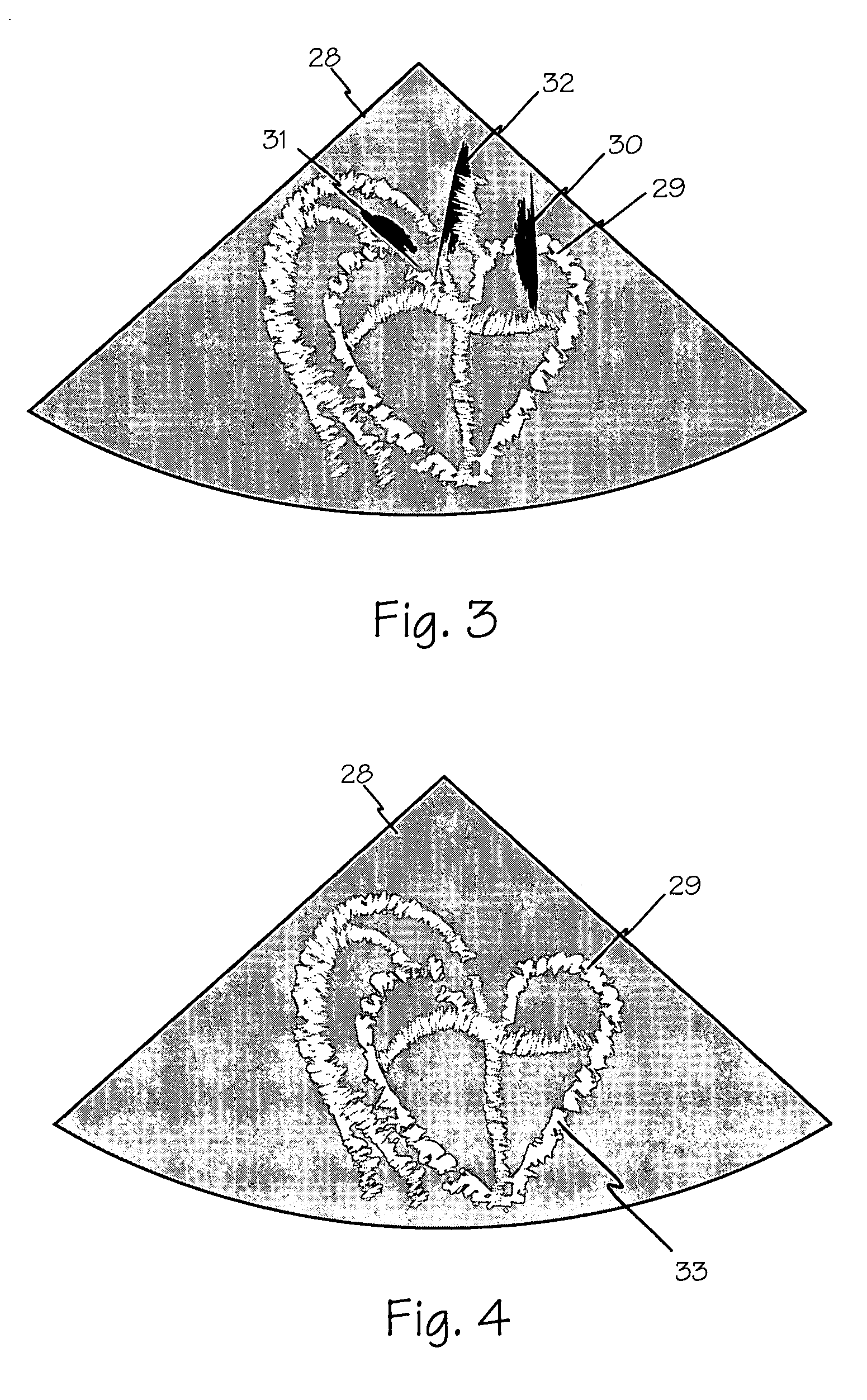 Method and apparatus for image enhanced external counterpulsation