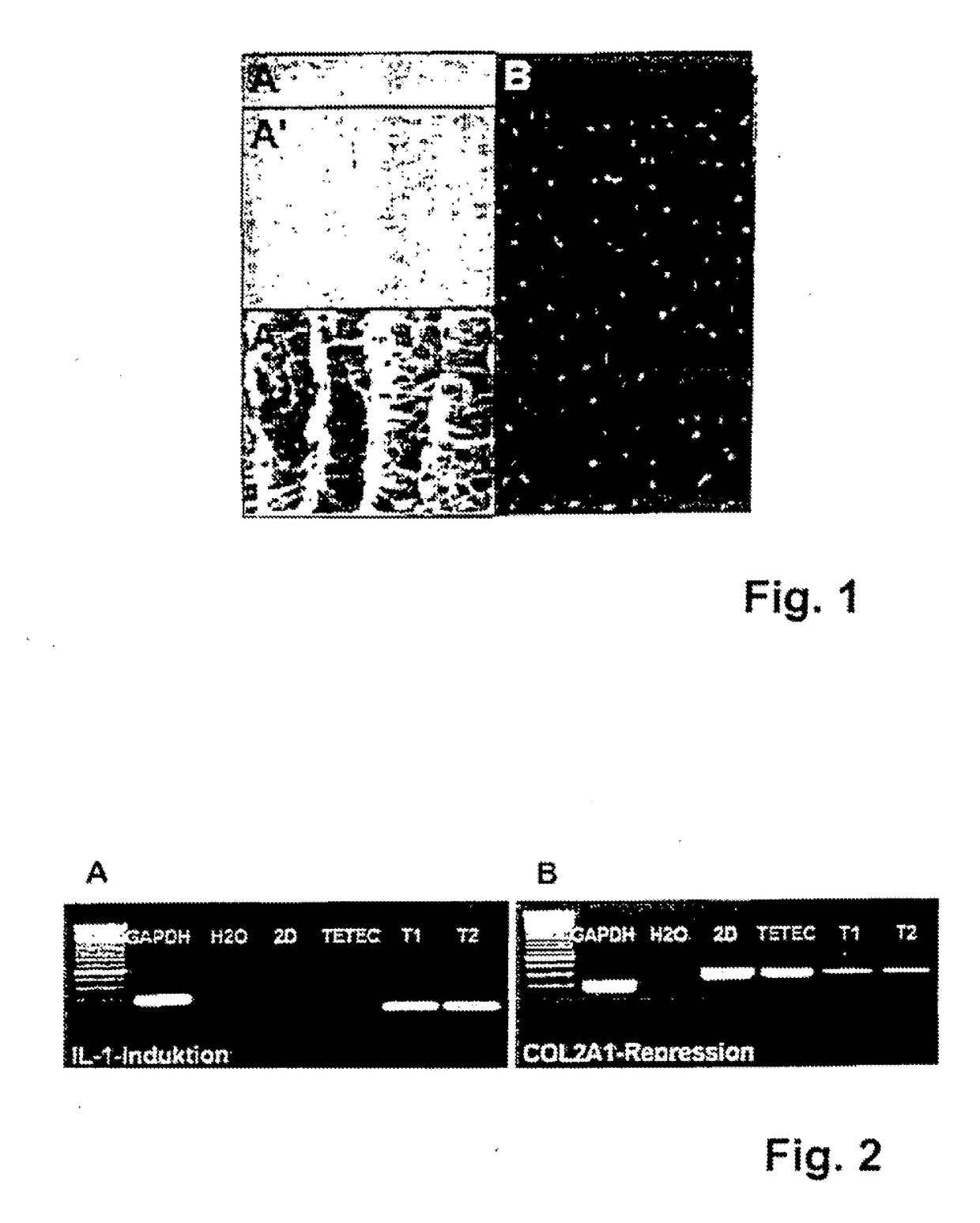 Implant for Repairing a Cartilage Defect