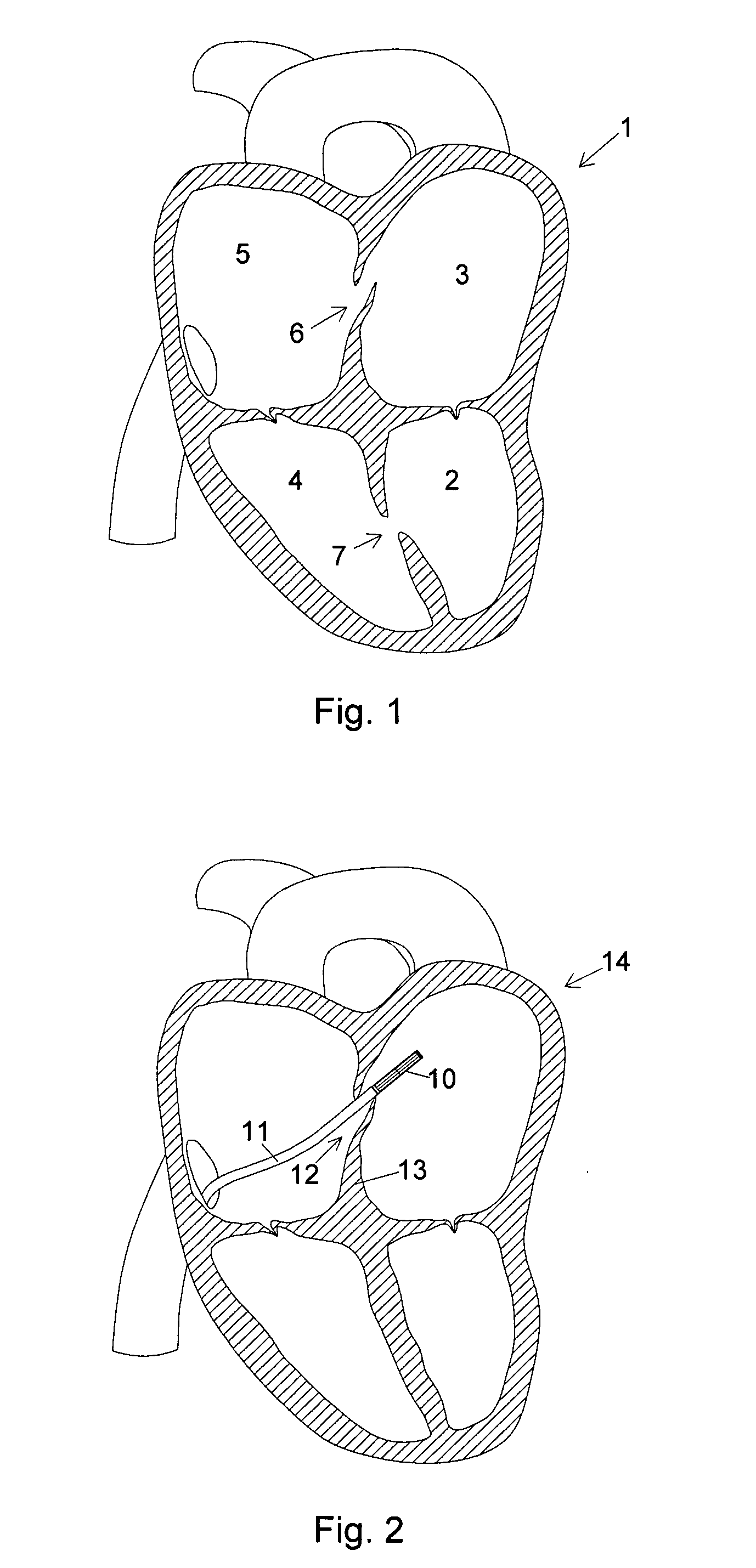 Closure device and insertion assembly