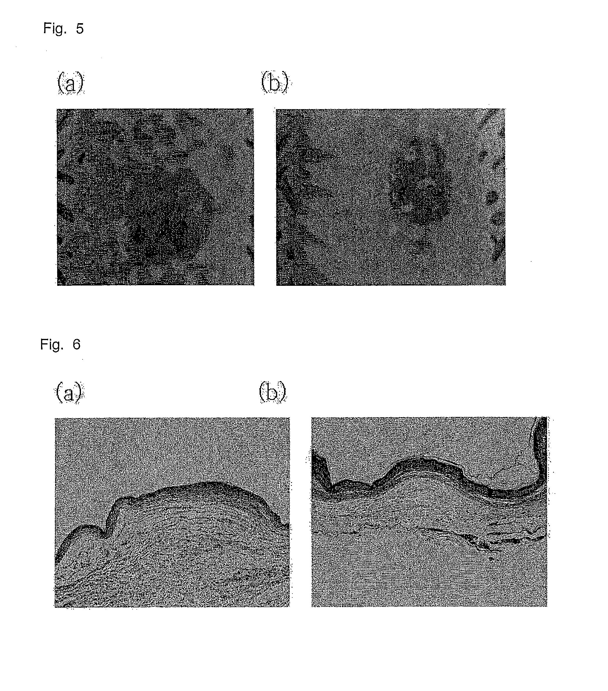 Hydrogel Type Cell Delivery Vehicle for Wound Healing, and Preparation Method Thereof