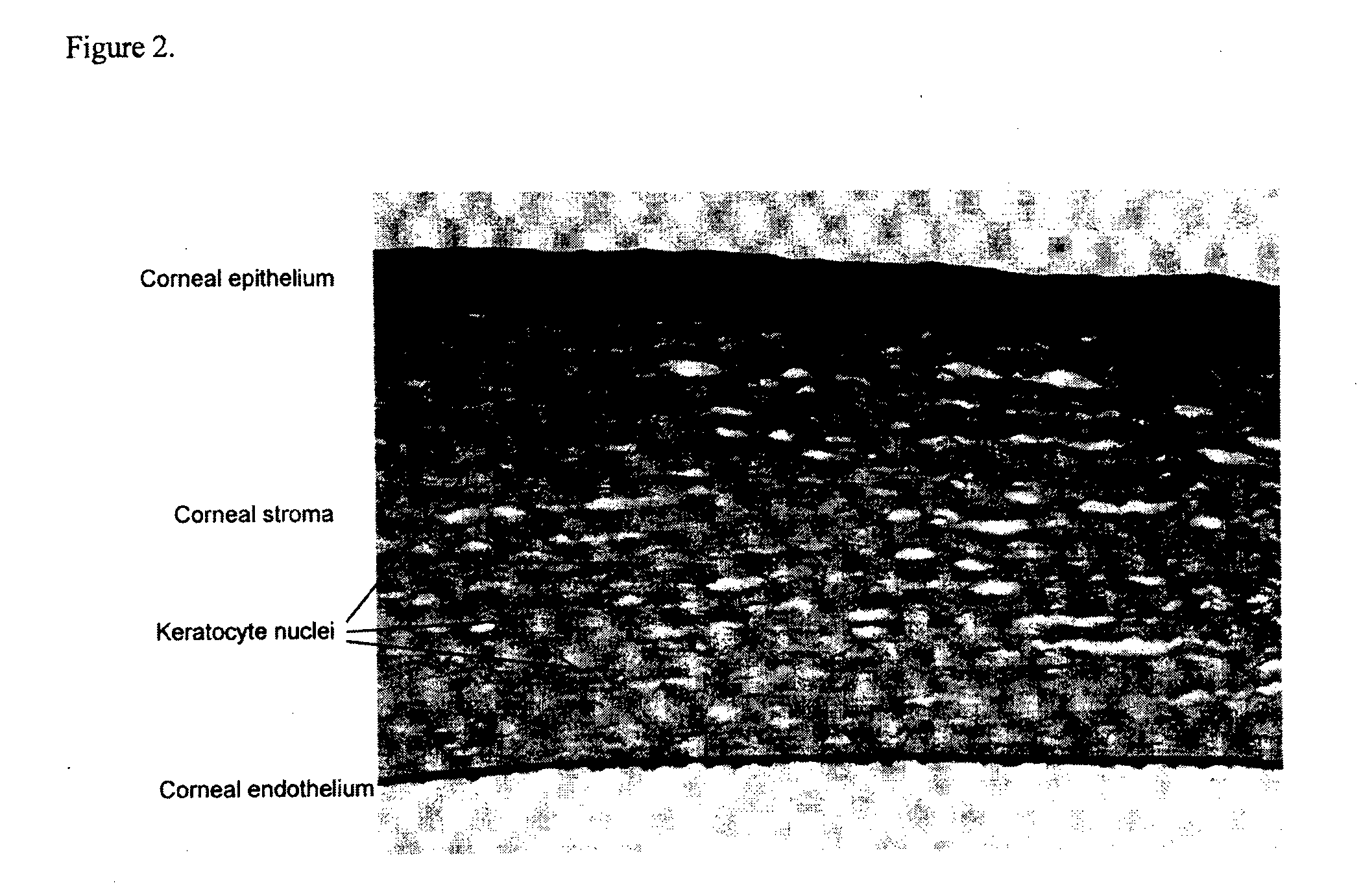 Lactoferrin seqences, compositions and methods for corneal wound treatment