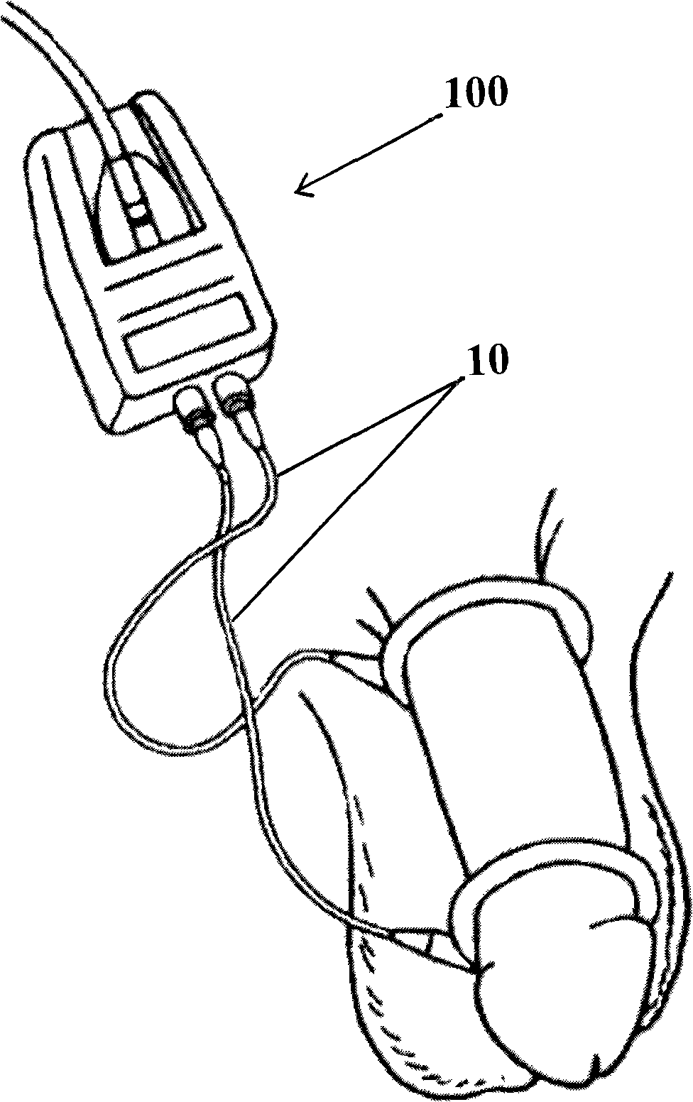Peris erection detection sensing device and detection device