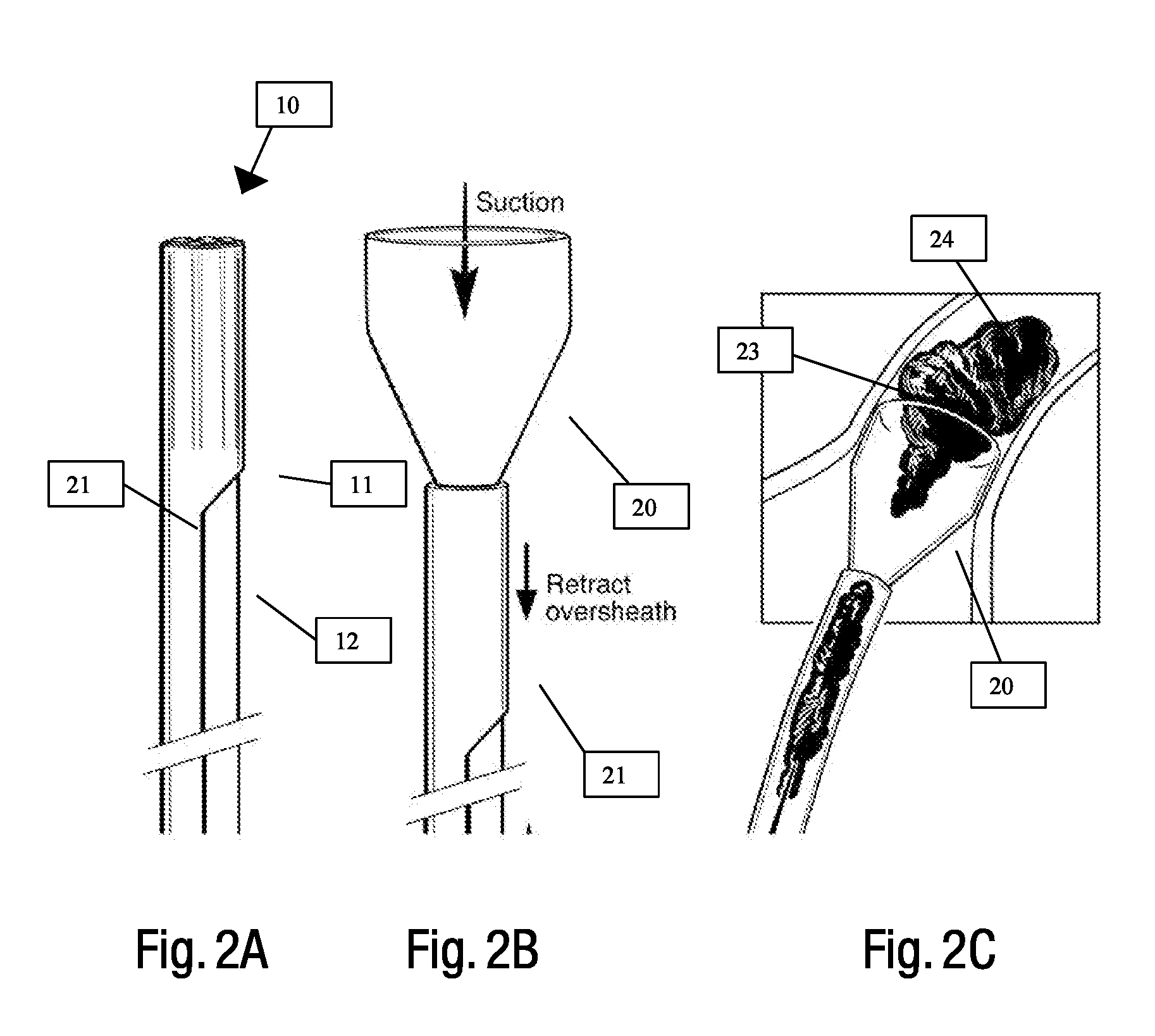 Systems and methods for removing undesirable material within a circulatory system