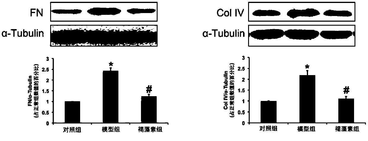 Use of fucoidin in preparing medicine for treating and/ or preventing renal fibrosis disease