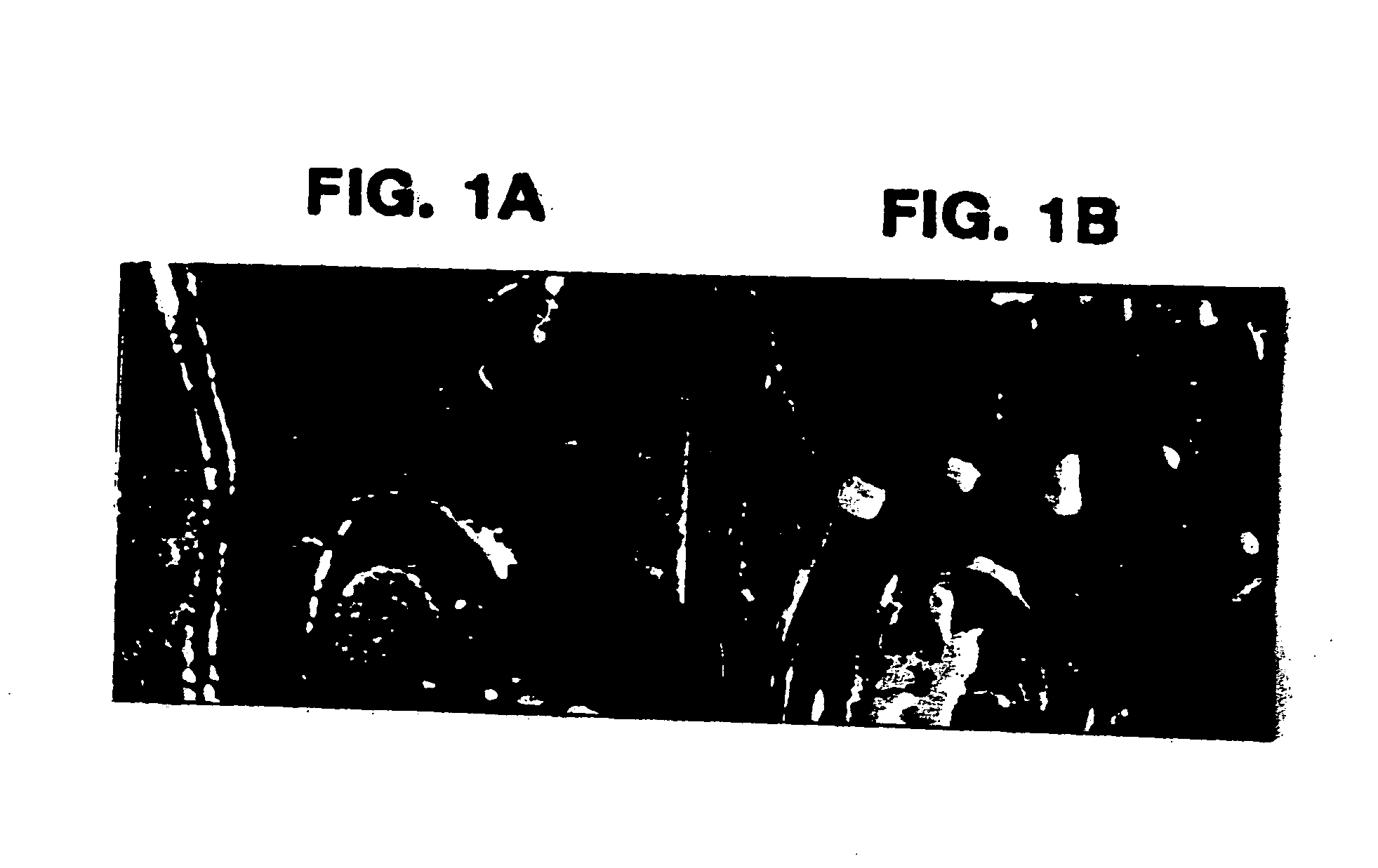 Method to prevent accelerated atherosclerosis using (sRAGE) soluble receptor for advanced glycation endproducts
