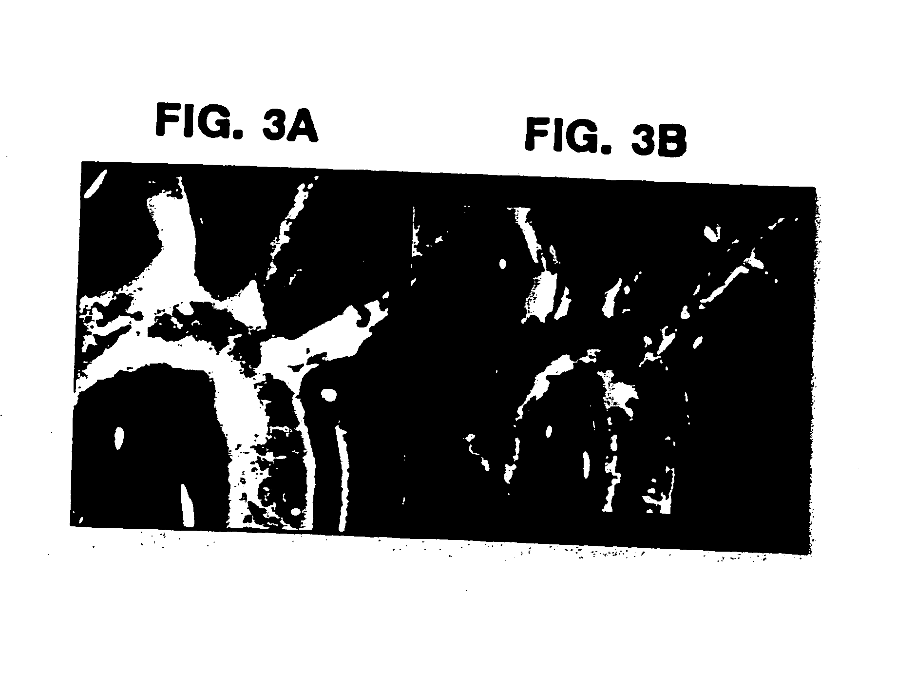 Method to prevent accelerated atherosclerosis using (sRAGE) soluble receptor for advanced glycation endproducts