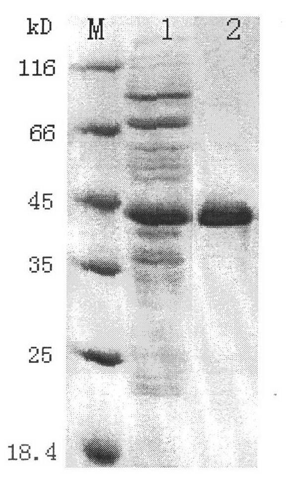 Multi-epitope artificial antigen of plasmodium falciparum and application thereof