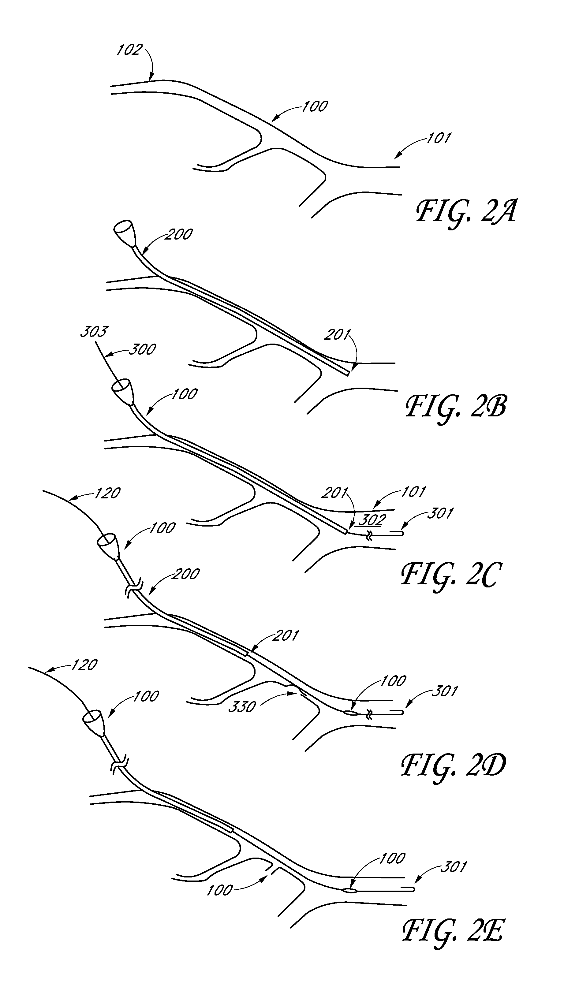 Method and devices for flow occlusion during device exchanges