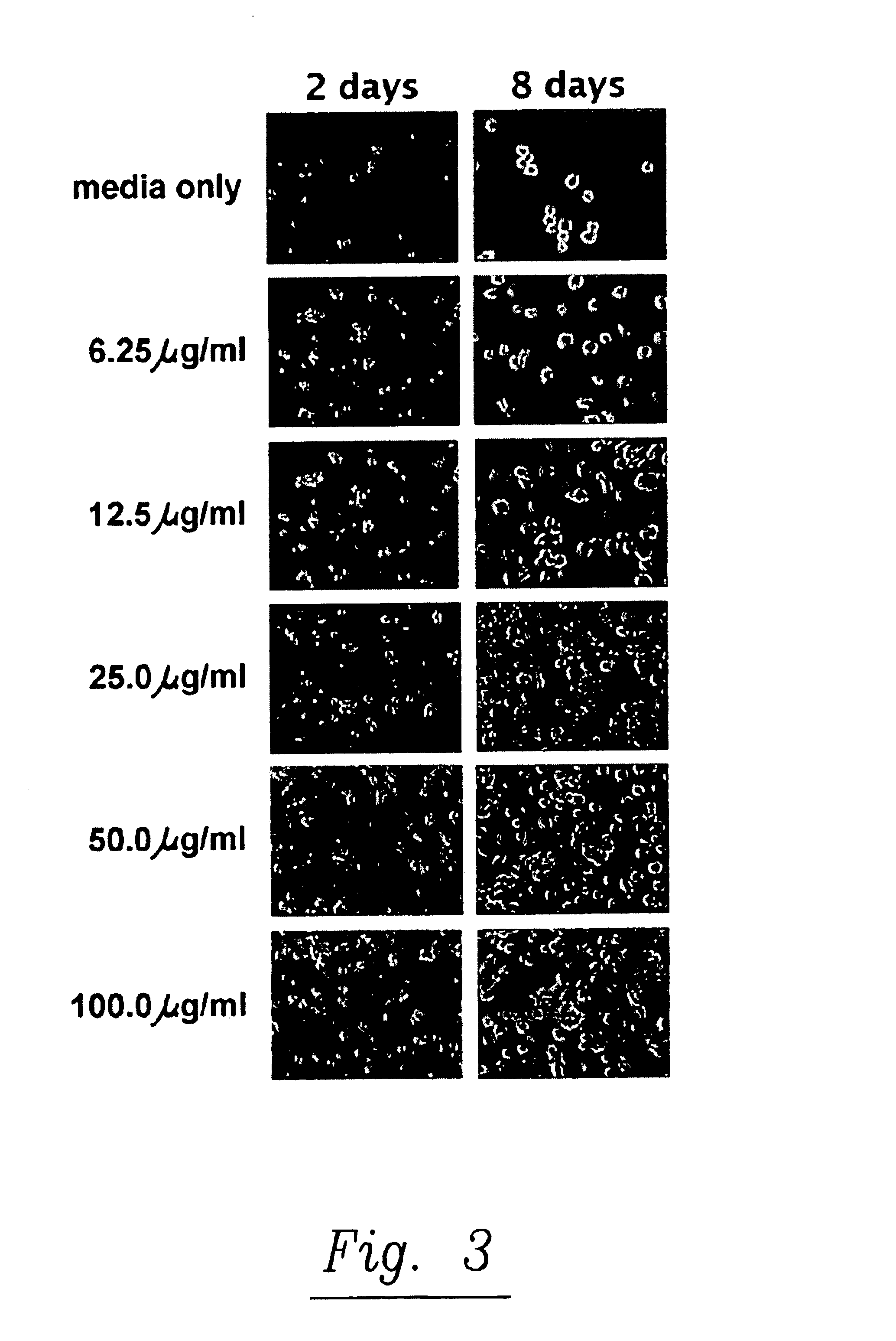 Pine cone extracts and uses thereof