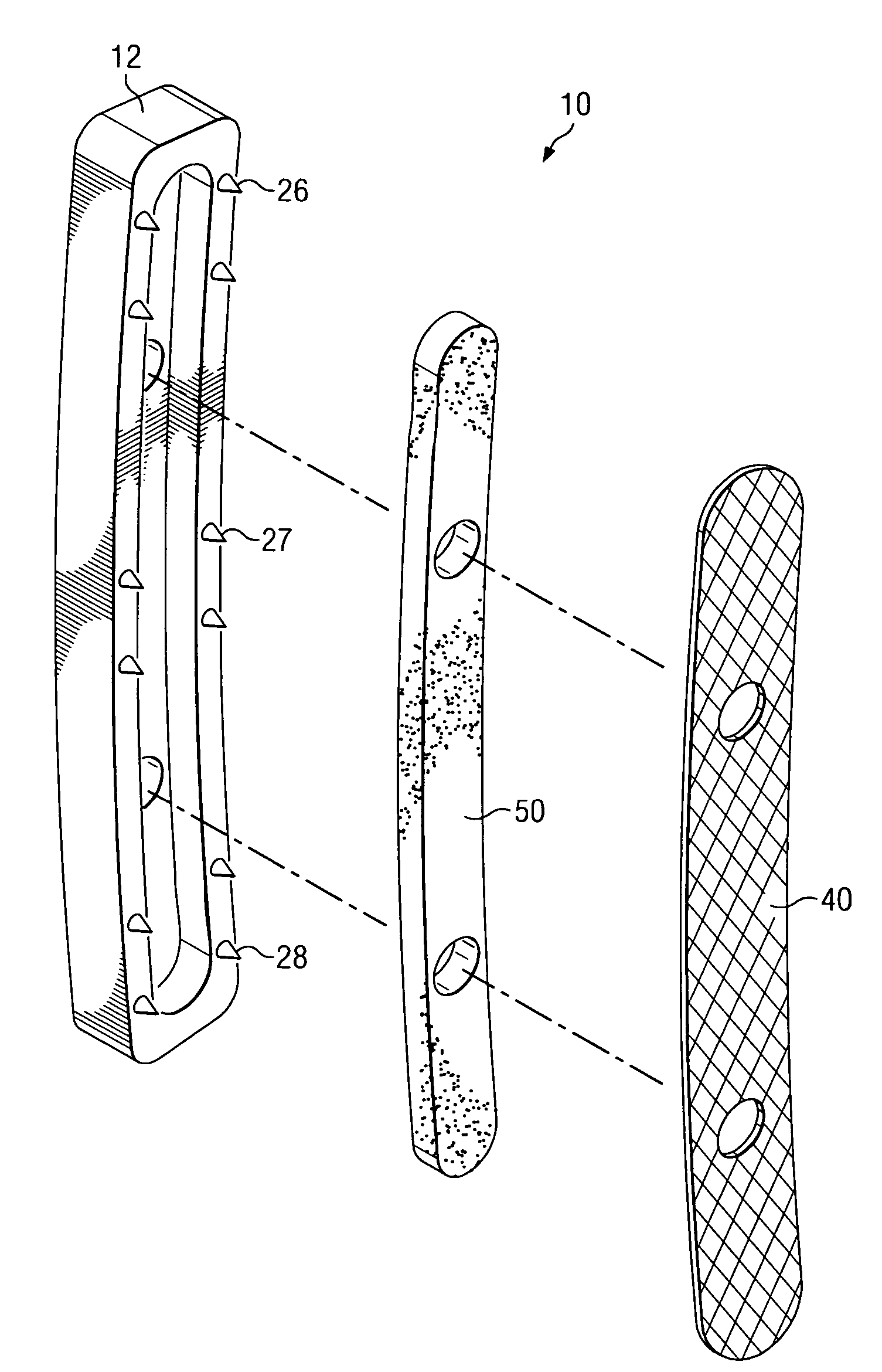 Fixation plate and method of use