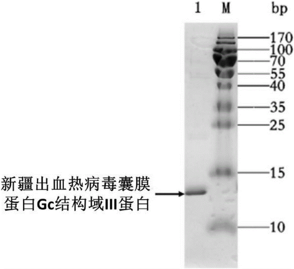 Single-domain antibody for neutralizing Xinjiang hemorrhagic fever virus